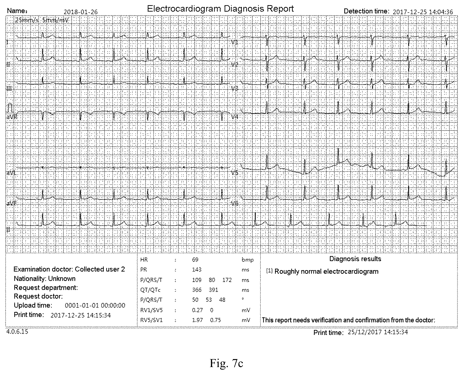 Patent US11783924 Figure 7 – ECG information processing method and ECG workstation