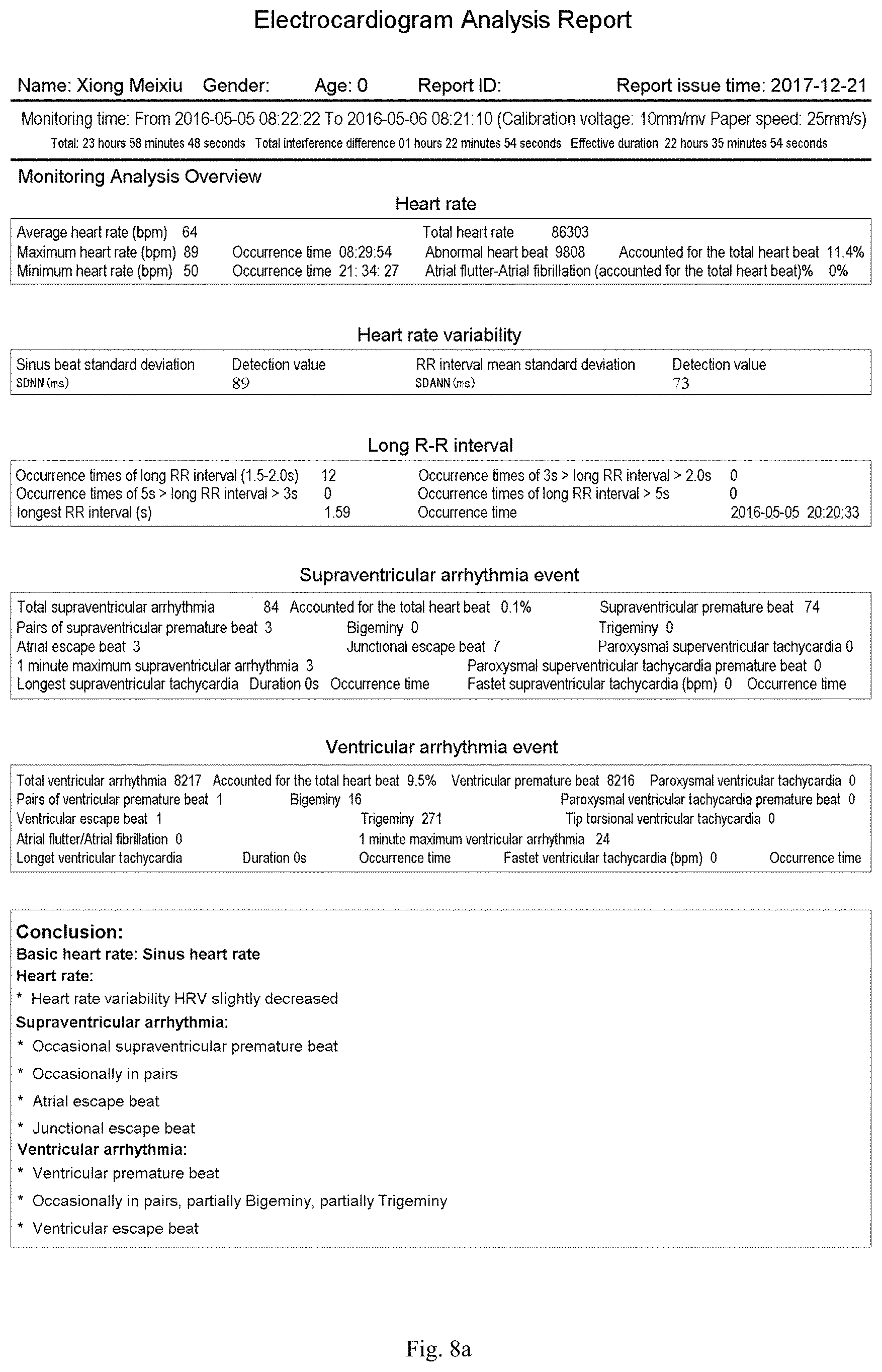 Patent US11783924 Figure 8 – ECG information processing method and ECG workstation
