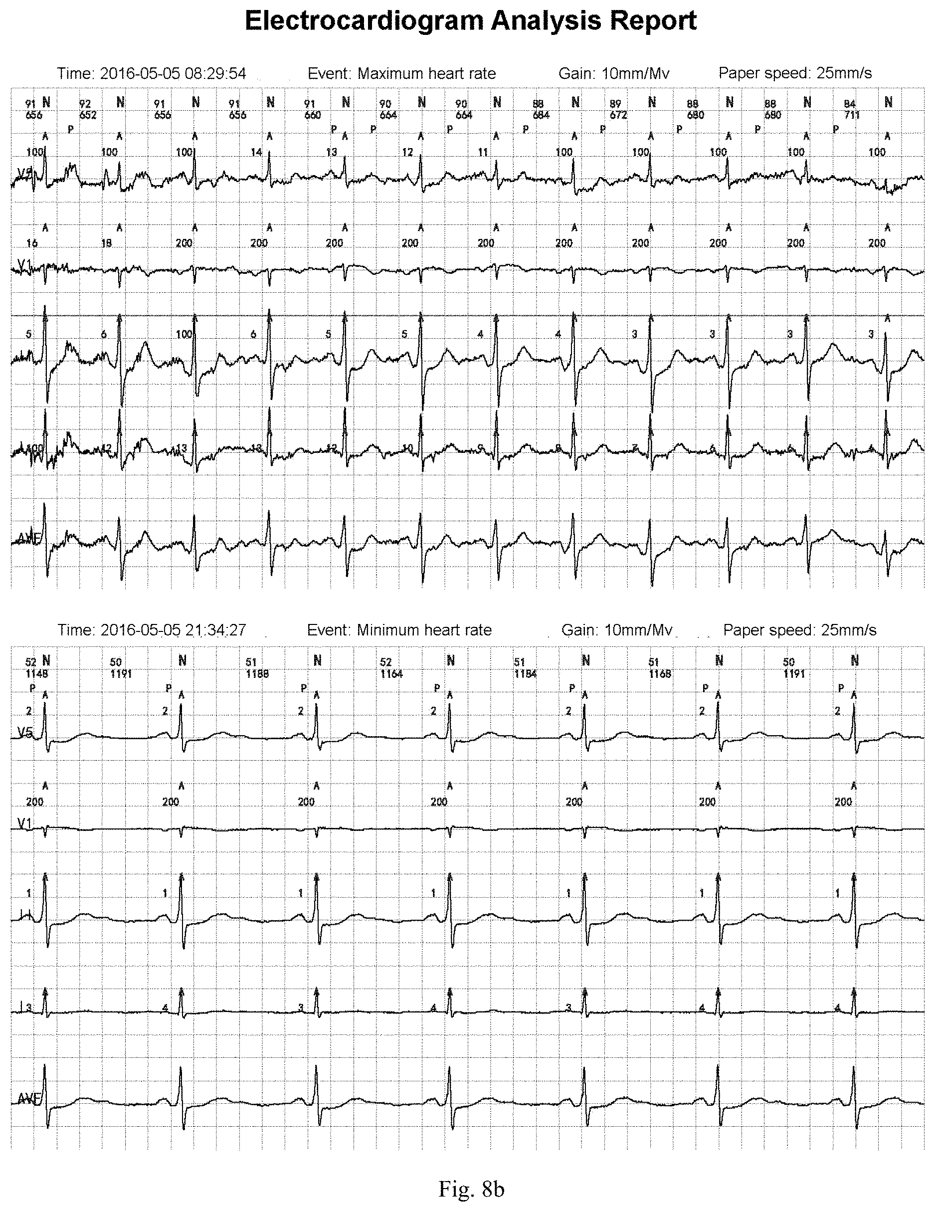 Patent US11783924 Figure 9 – ECG information processing method and ECG workstation