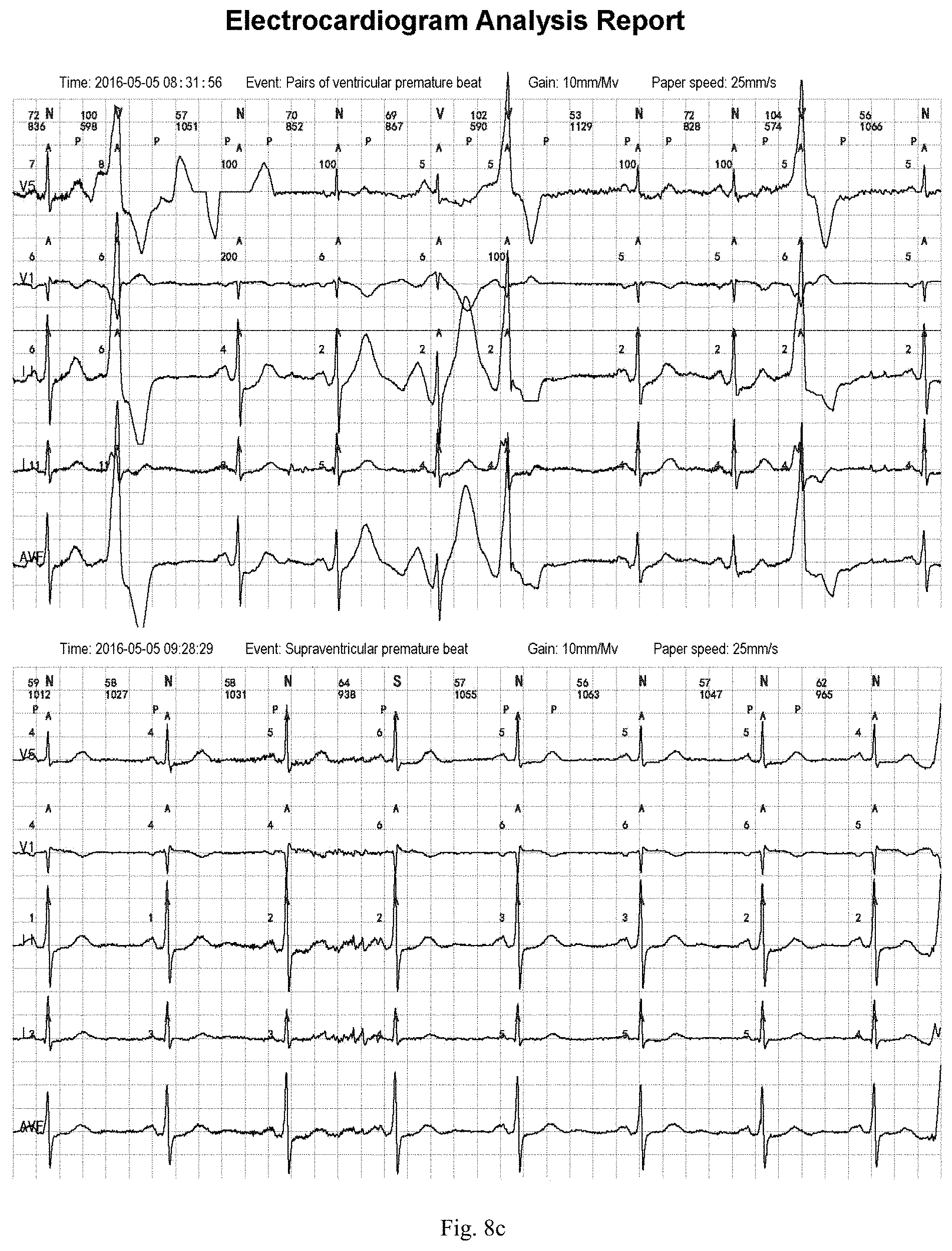 Patent US11783924 Figure 10 – ECG information processing method and ECG workstation
