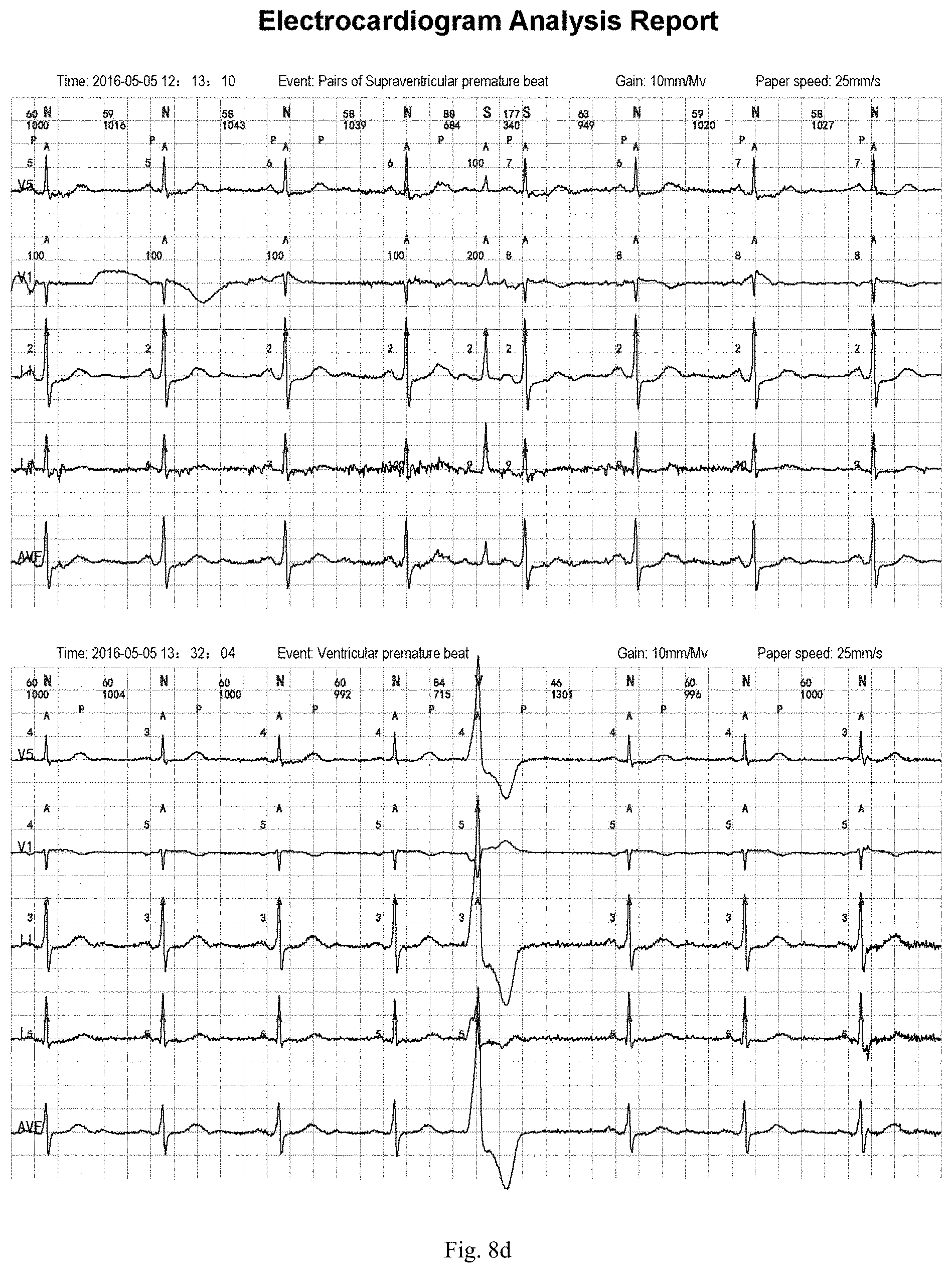 Patent US11783924 Figure 11 – ECG information processing method and ECG workstation