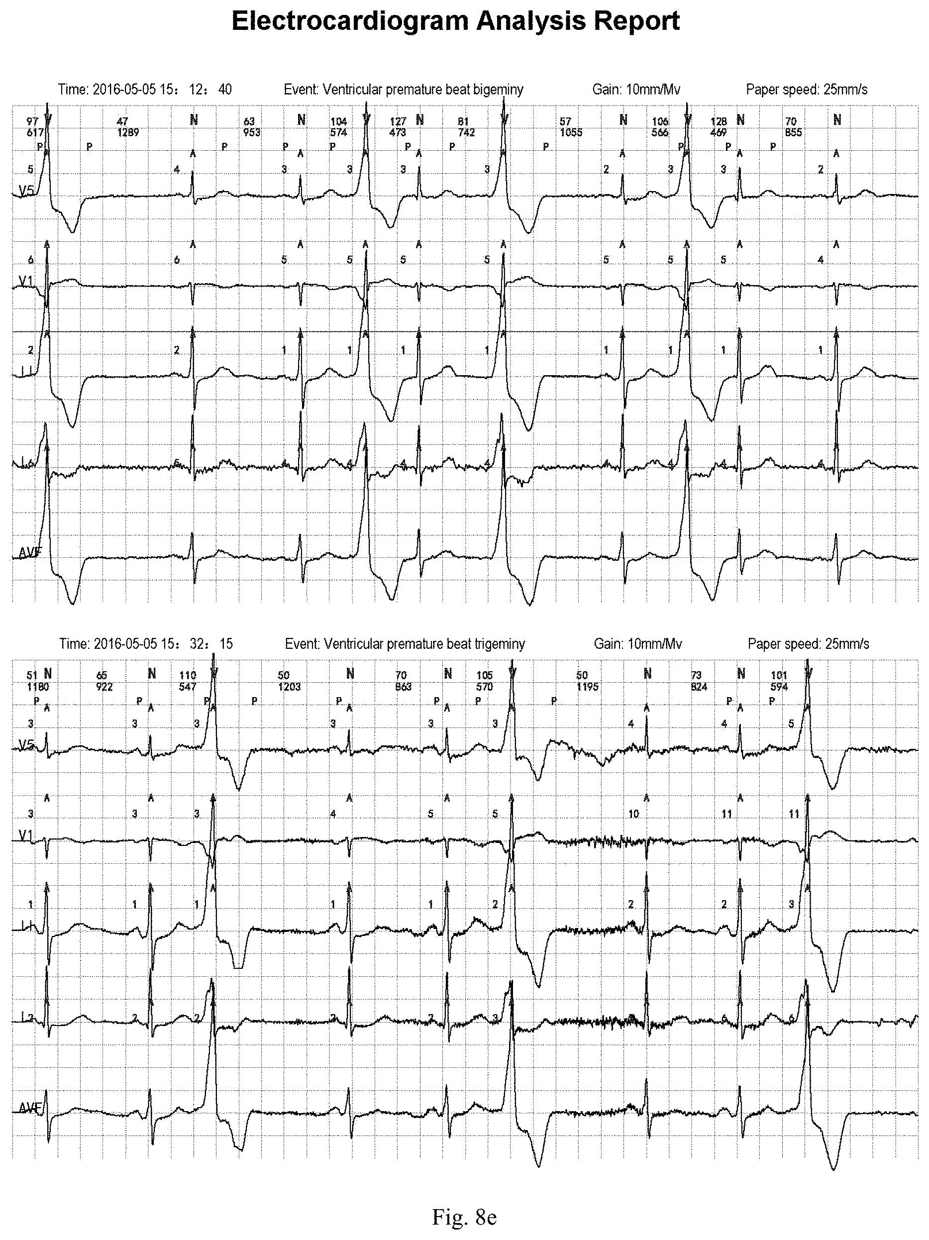 Patent US11783924 Figure 12 – ECG information processing method and ECG workstation