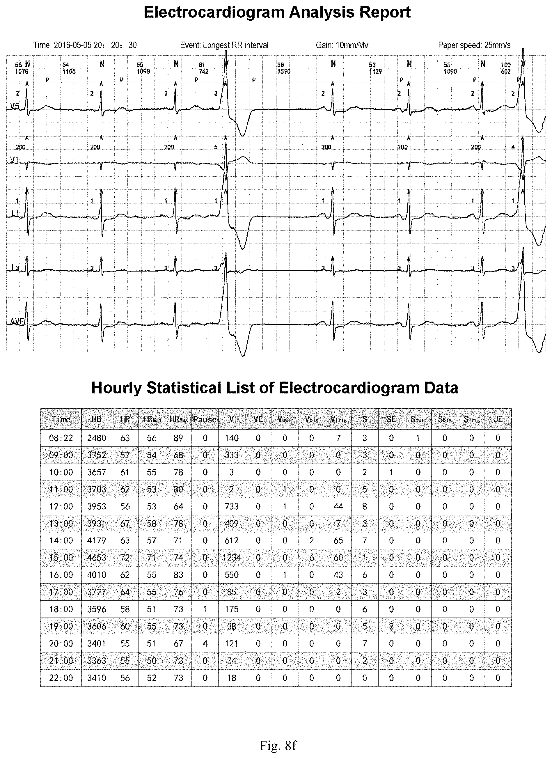 Patent US11783924 Figure 13 – ECG information processing method and ECG workstation