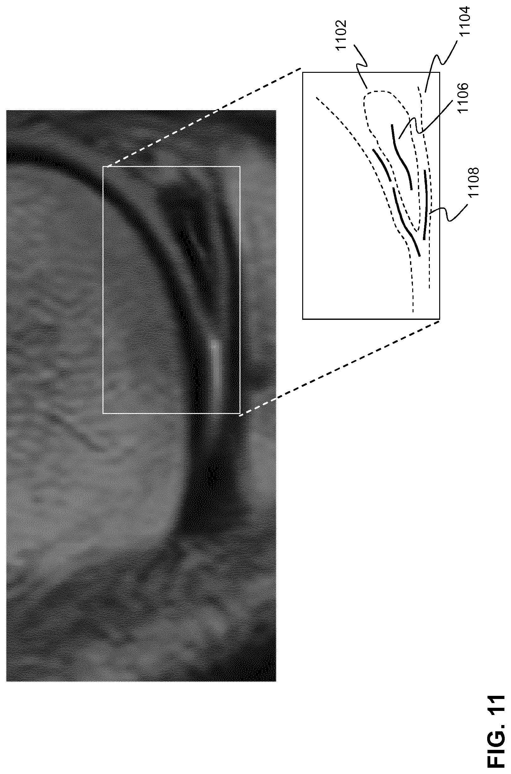 Patent US11783936 Figure 11 – Computer-aided diagnostics using deep neural networks