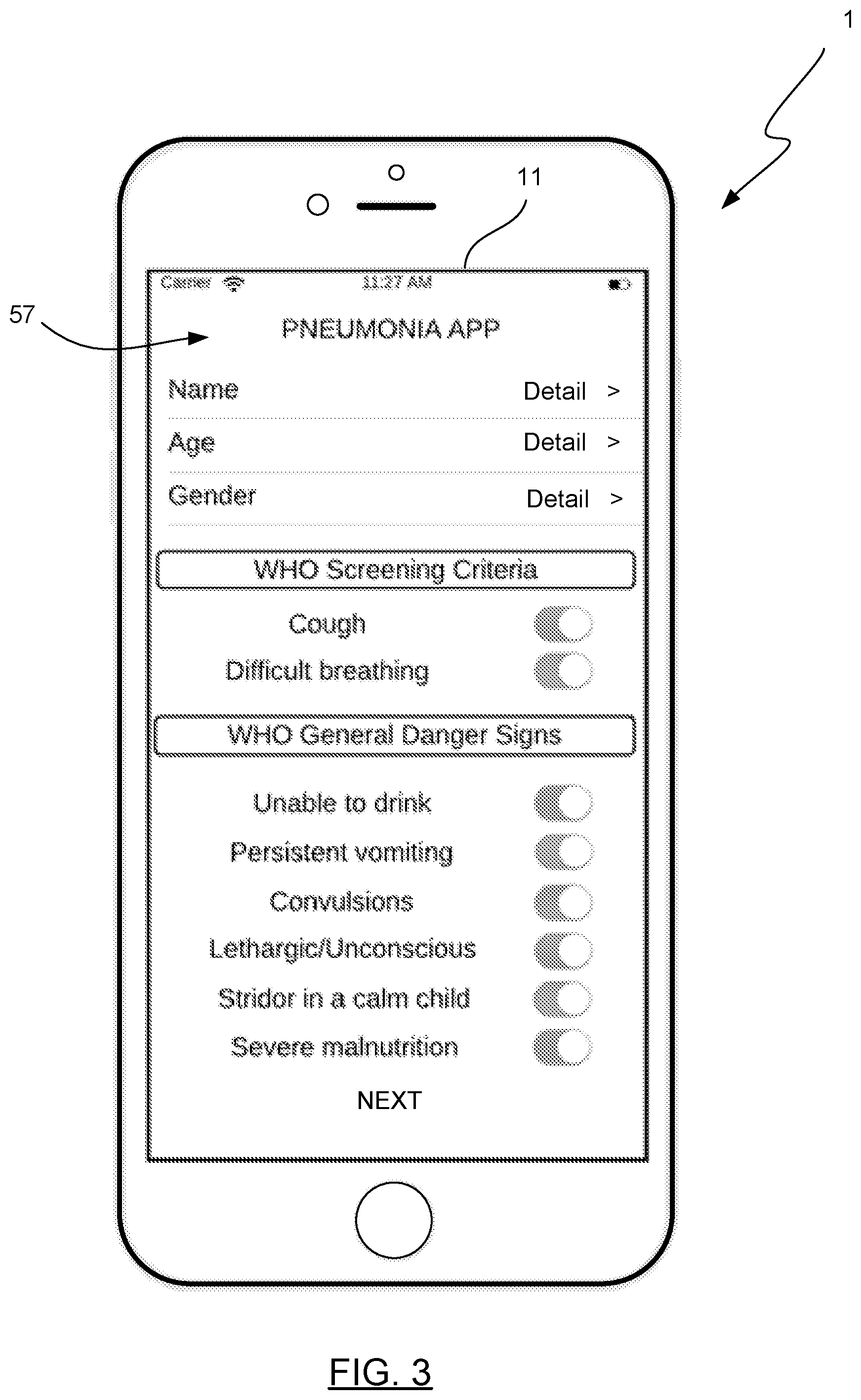Patent US11783947 Figure 3 – Method and apparatus for automatic disease state diagnosis