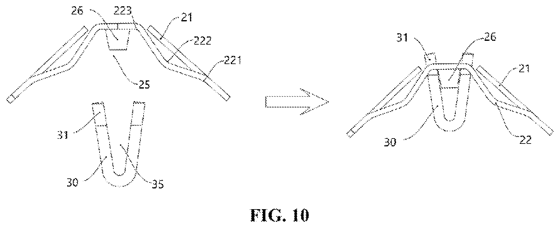 Patent US11784421 Figure 7 – Self-coupled wire connector using bend spring sheet and conductor sheet