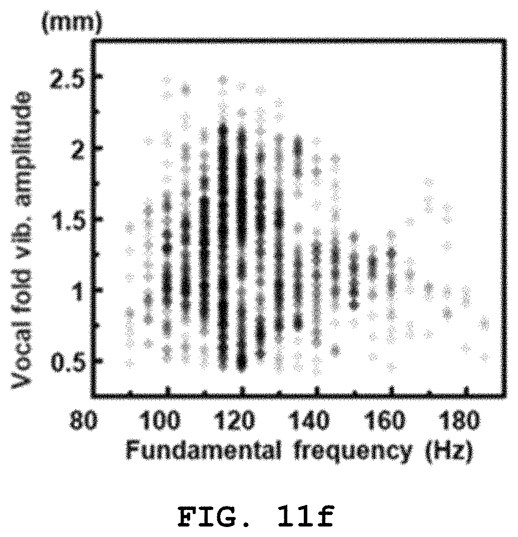 Patent US11785370 Figure 15 – Attachable vibration sensor and method for manufacturing same