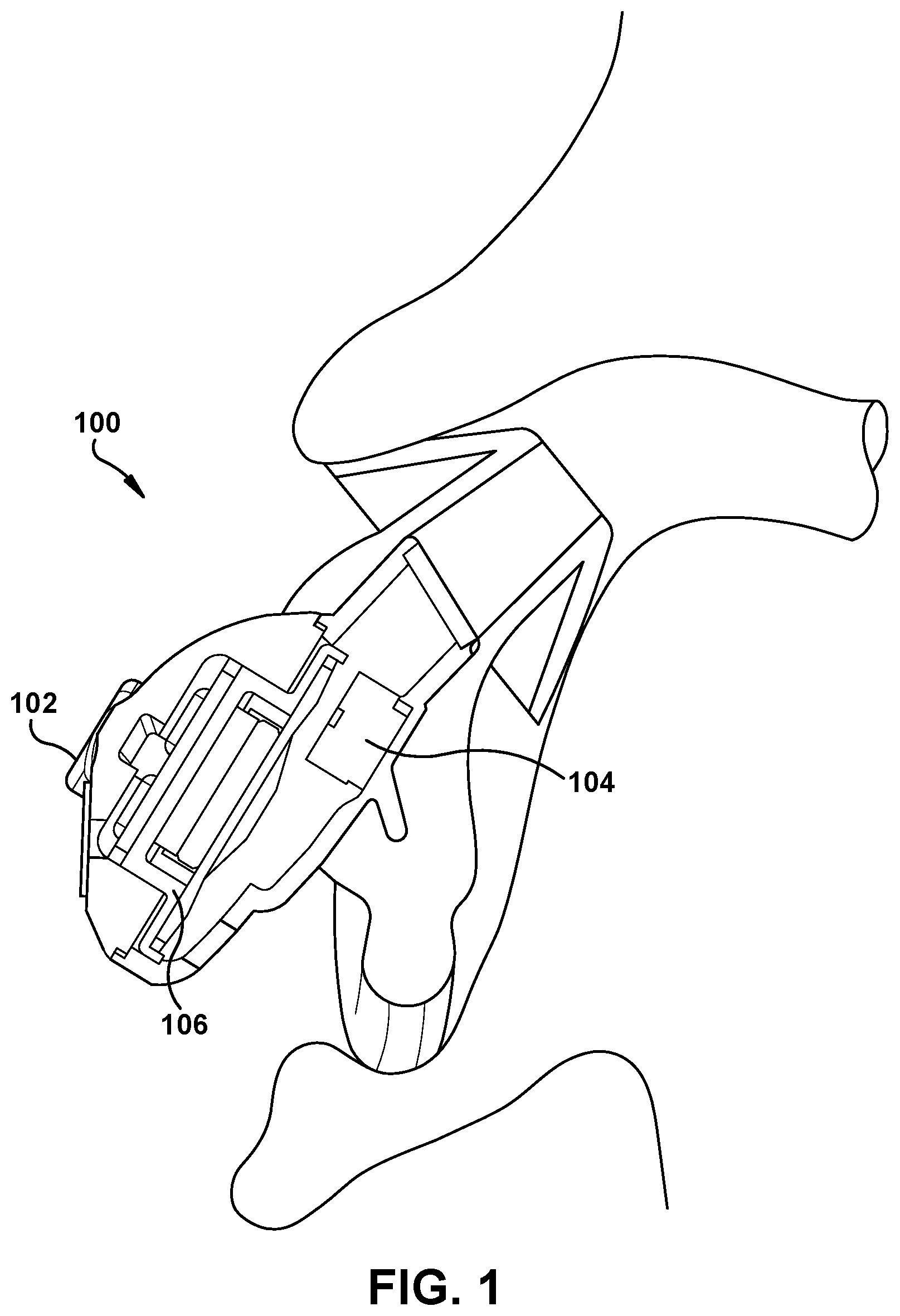 Patent US11785382 — Gain-adaptive active noise reduction (ANR) device — Figure 1
