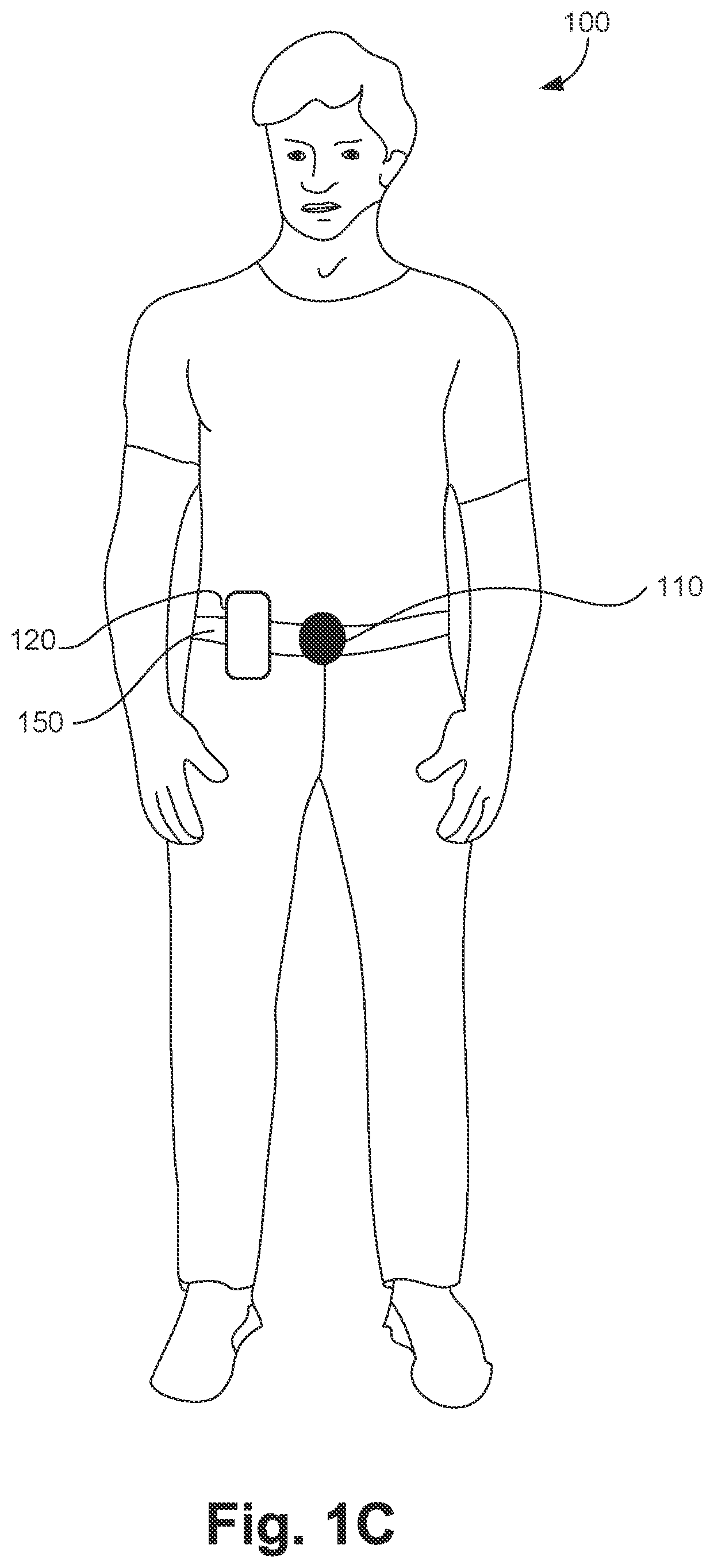 Patent US11785395 Figure 3 – Hearing aid with voice recognition