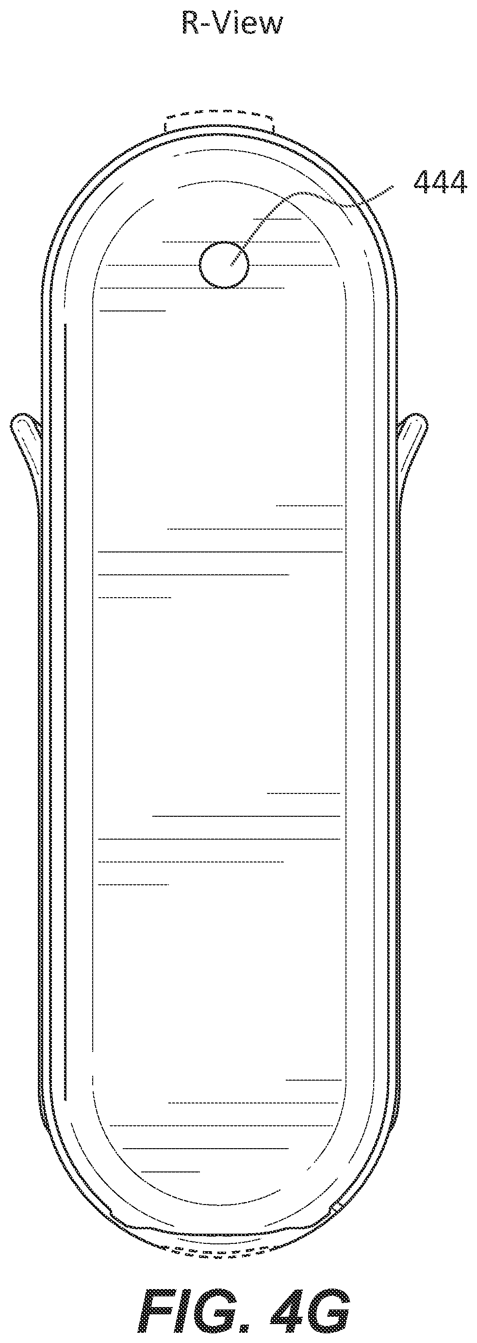 Patent US11785395 Figure 14 – Hearing aid with voice recognition