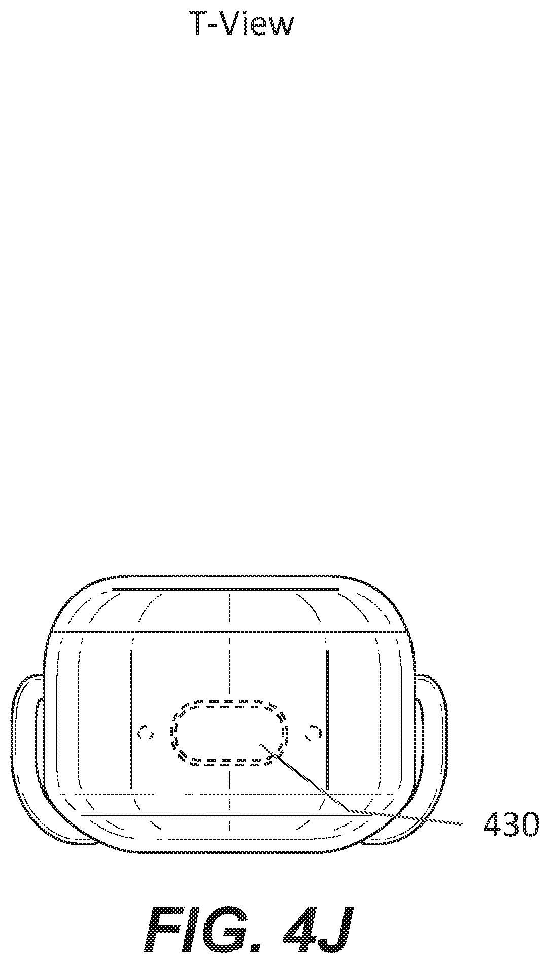 Patent US11785395 Figure 17 – Hearing aid with voice recognition
