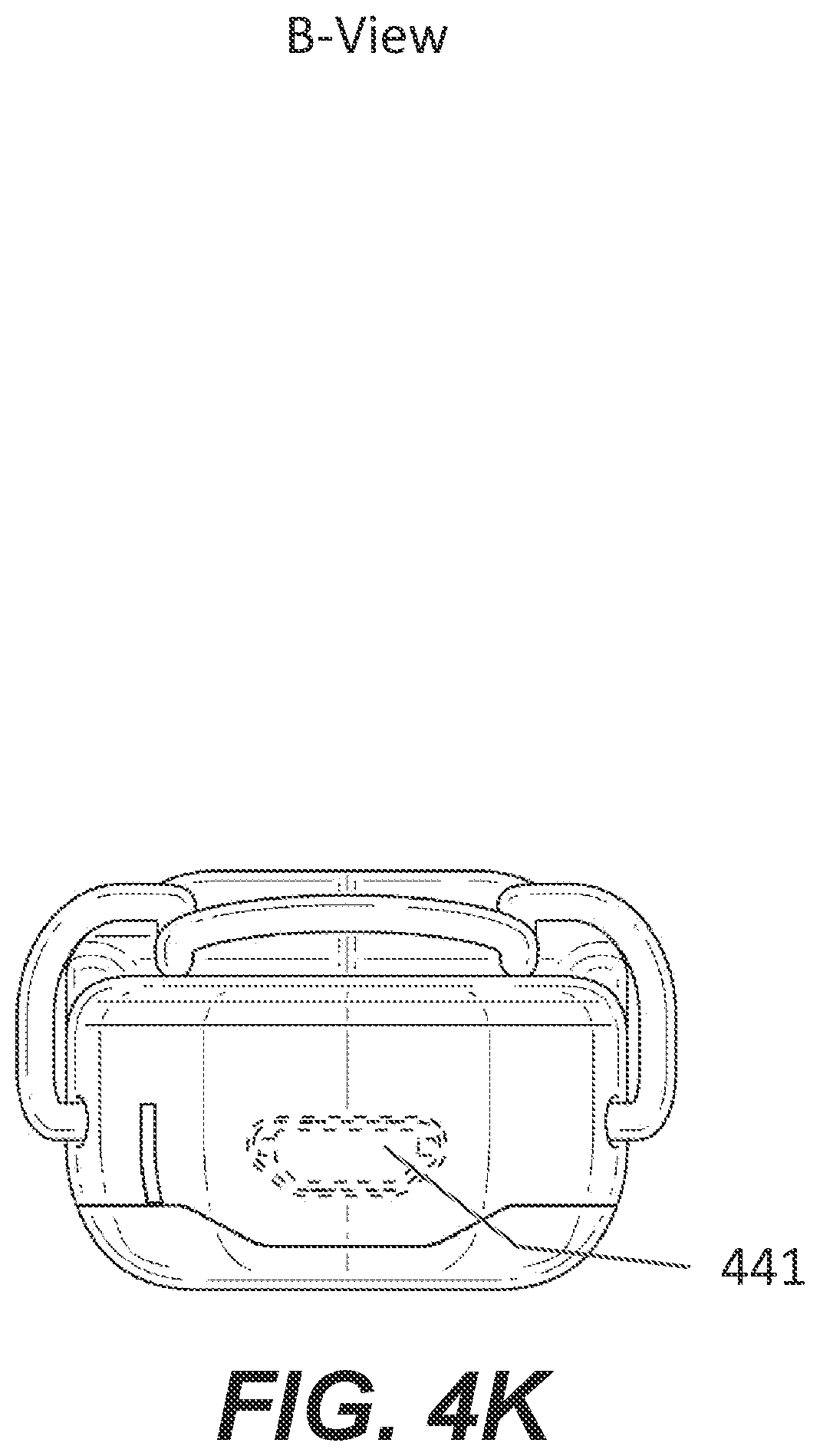 Patent US11785395 Figure 18 – Hearing aid with voice recognition