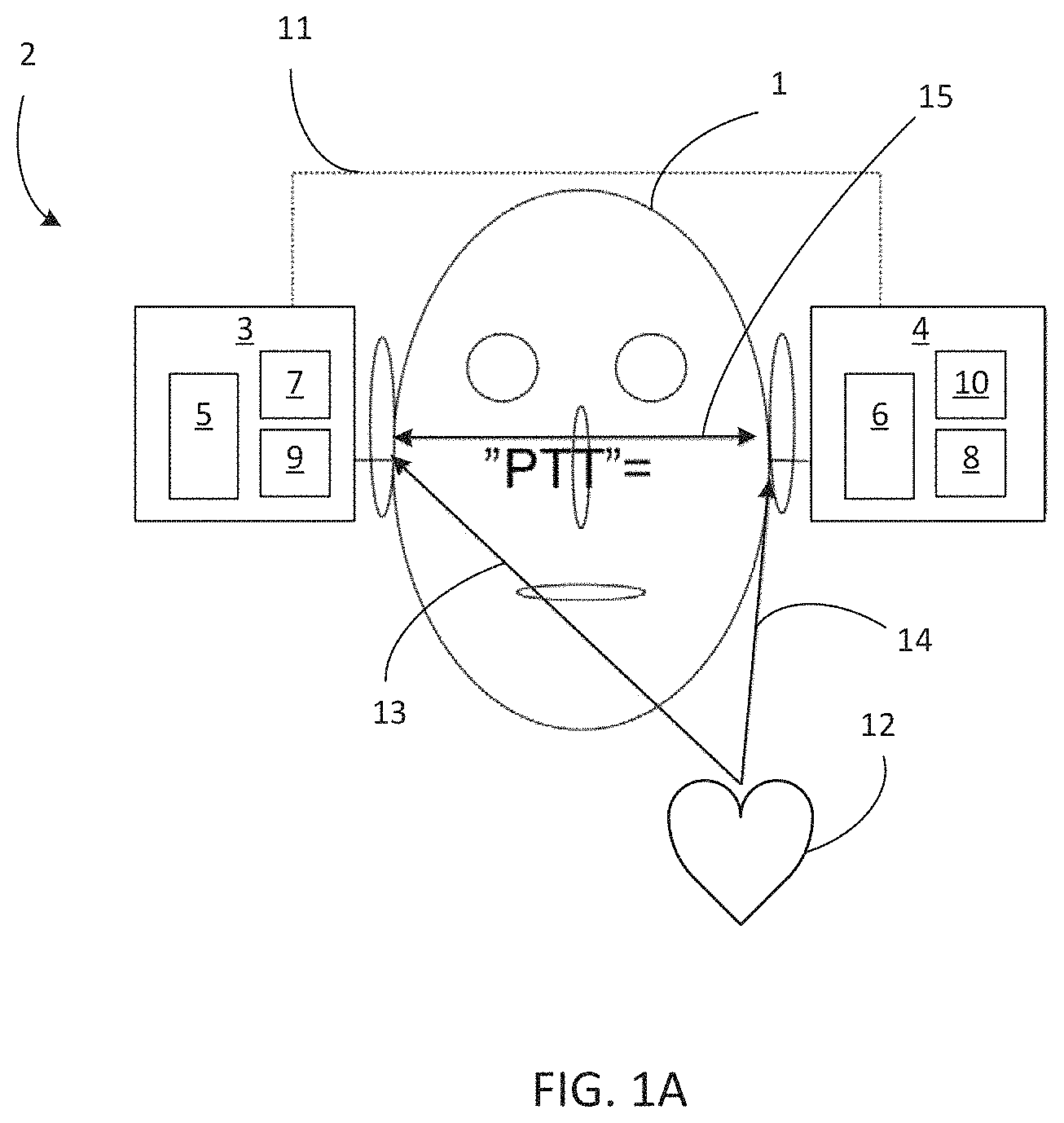 Patent US11785397 Figure 1 – Hearing aid comprising a physiological sensor