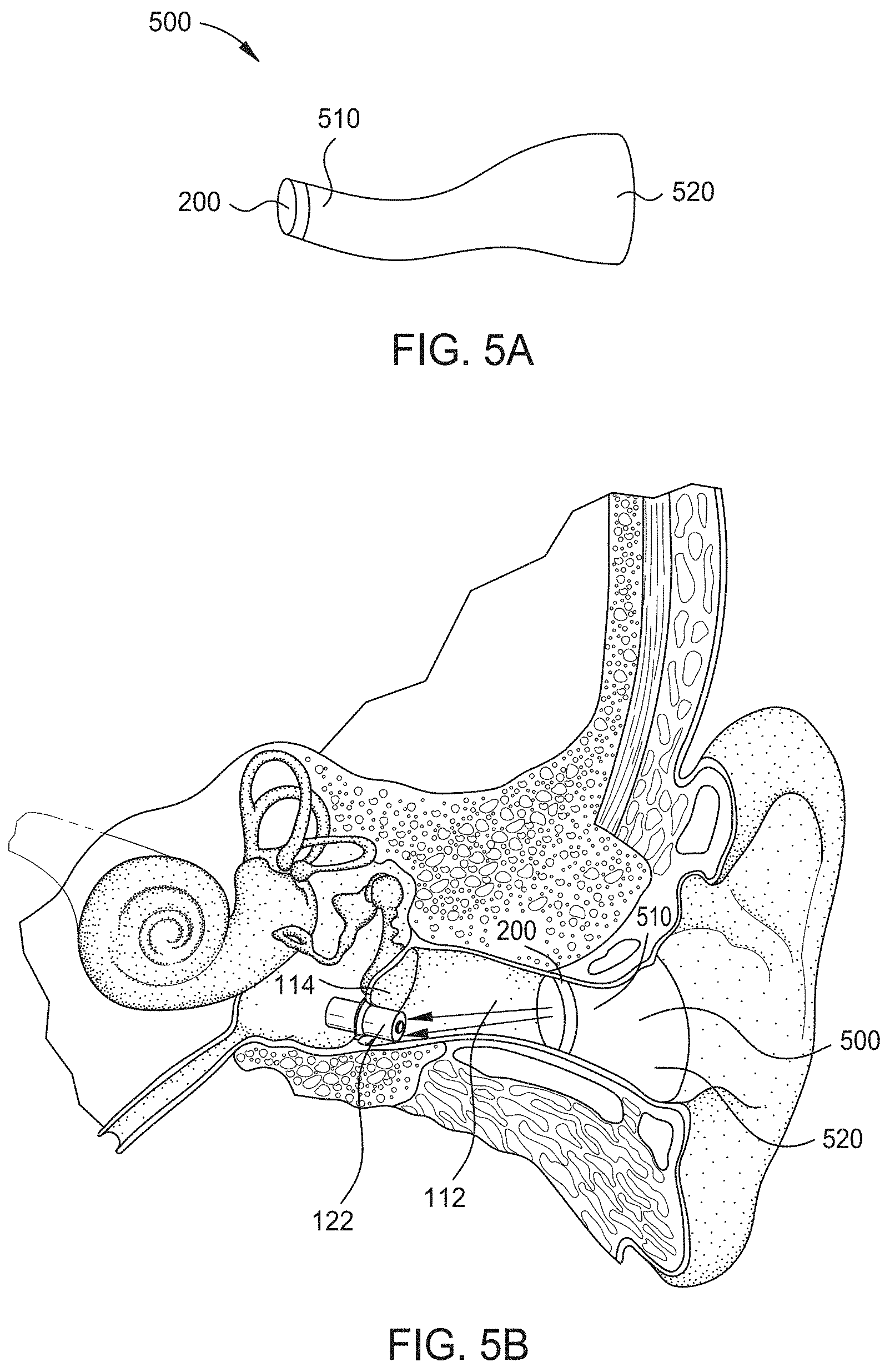 Patent US11785401 Figure 5 – Hearing aid implant recharging system