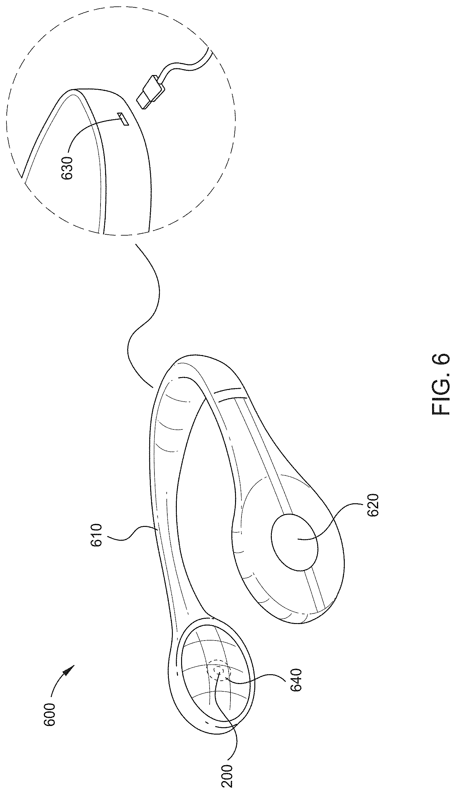 Patent US11785401 Figure 6 – Hearing aid implant recharging system