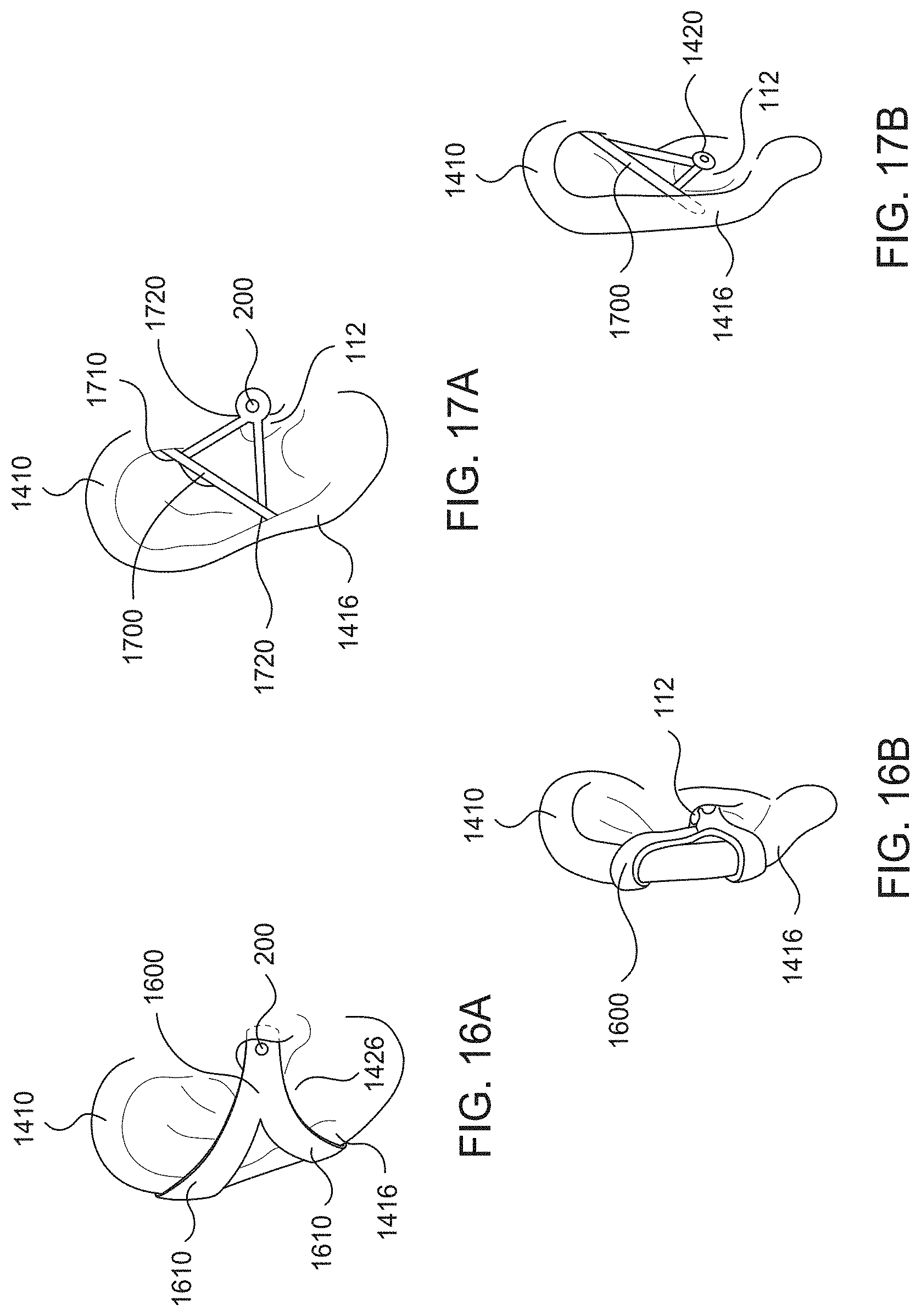 Patent US11785401 Figure 15 – Hearing aid implant recharging system
