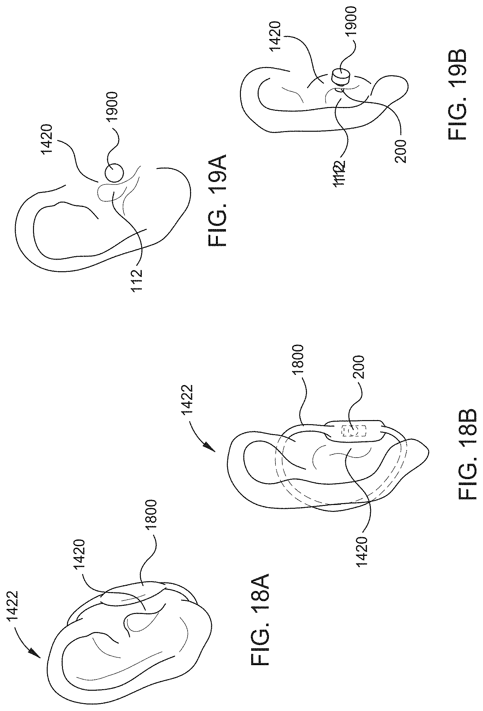Patent US11785401 Figure 16 – Hearing aid implant recharging system