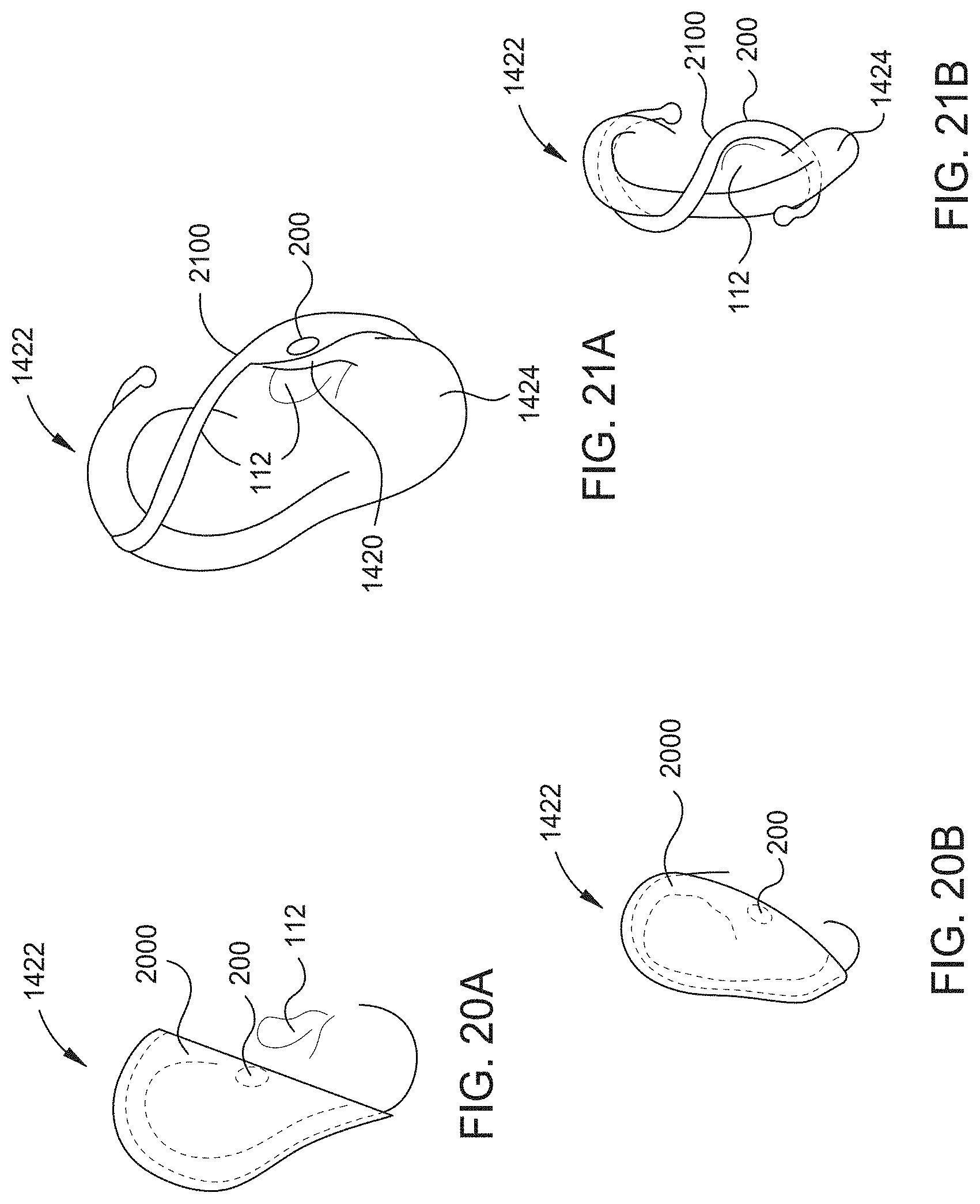 Patent US11785401 Figure 17 – Hearing aid implant recharging system