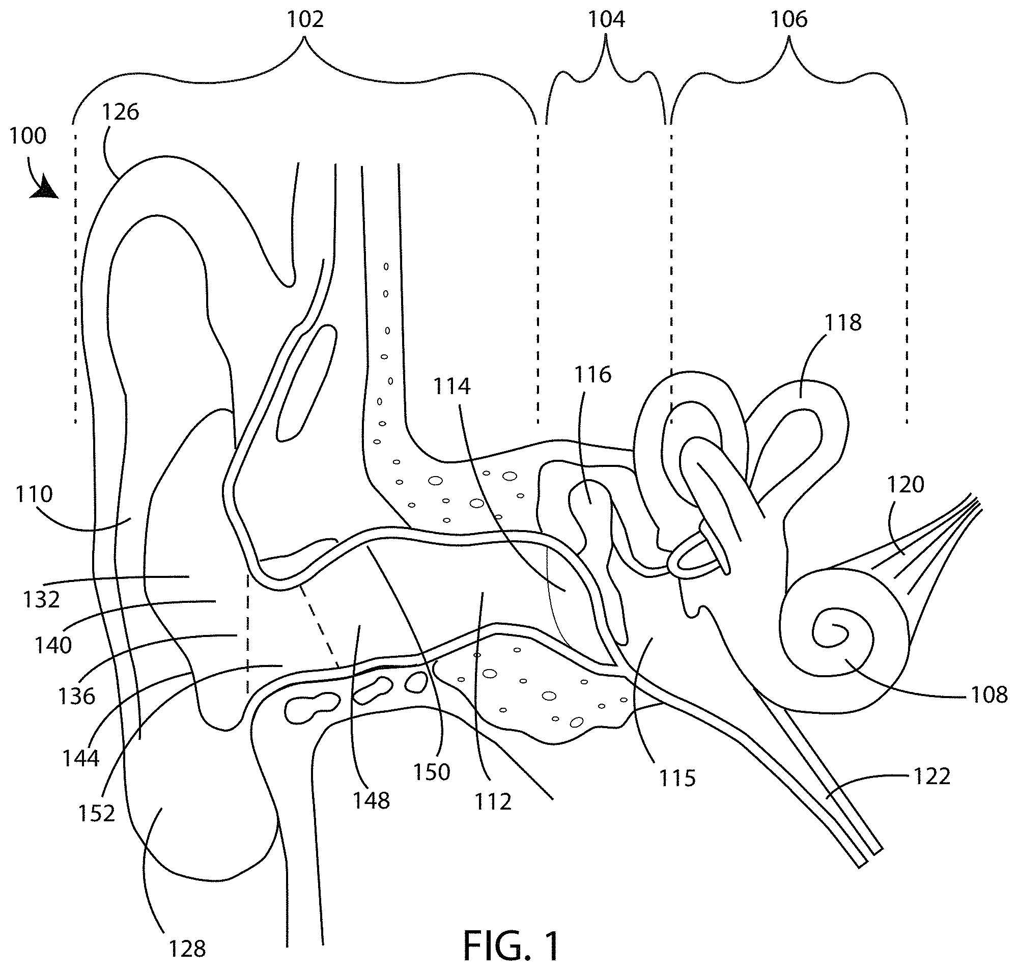 Patent US11785403 Figure 1 – Device to optically verify custom hearing aid fit and method of use