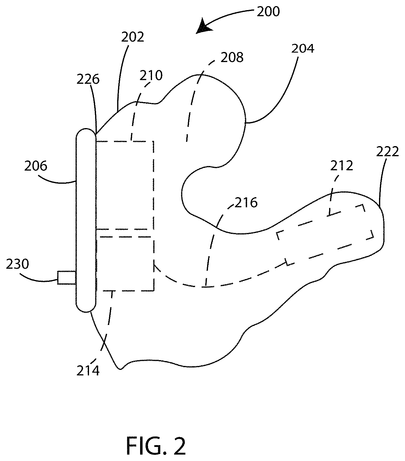 Patent US11785403 Figure 2 – Device to optically verify custom hearing aid fit and method of use