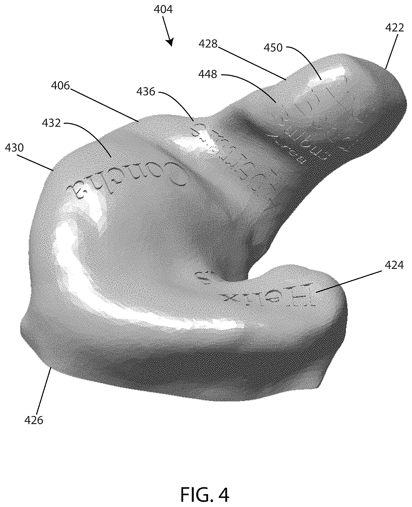 Patent US11785403 Figure 4 – Device to optically verify custom hearing aid fit and method of use