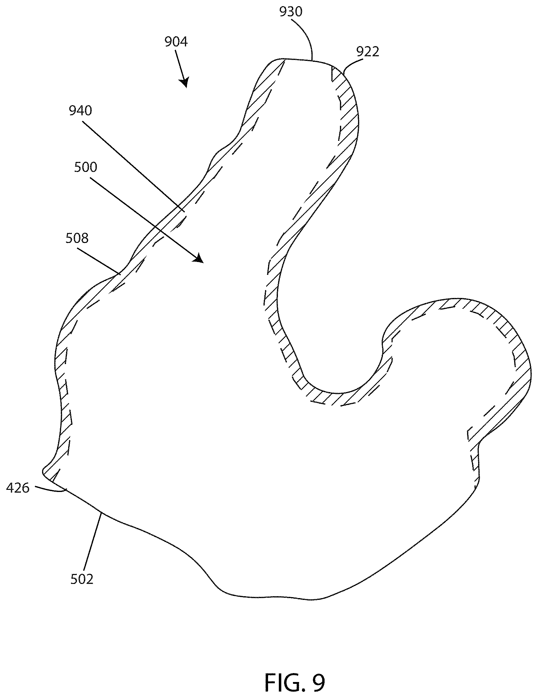Patent US11785403 Figure 9 – Device to optically verify custom hearing aid fit and method of use