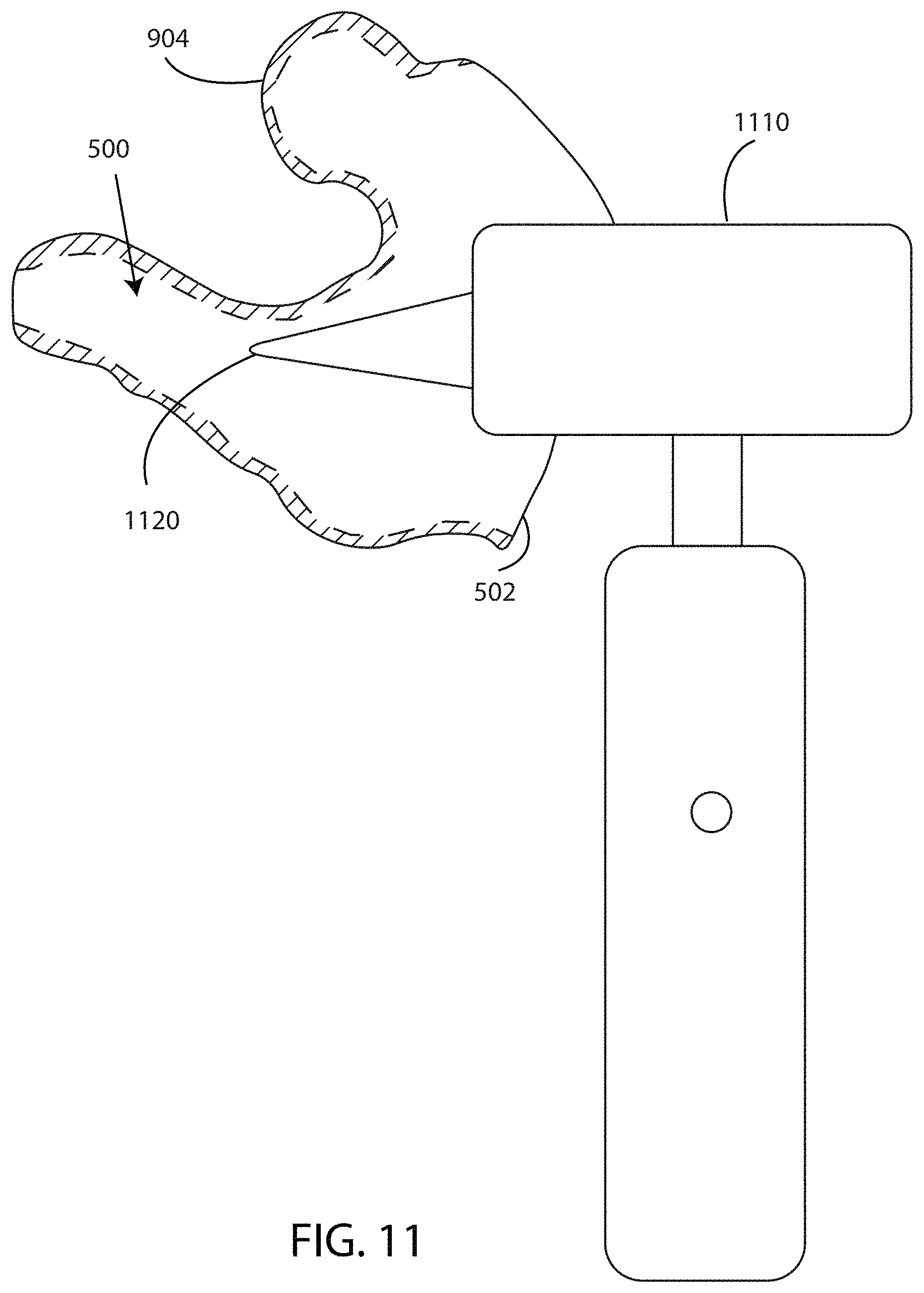 Patent US11785403 Figure 11 – Device to optically verify custom hearing aid fit and method of use