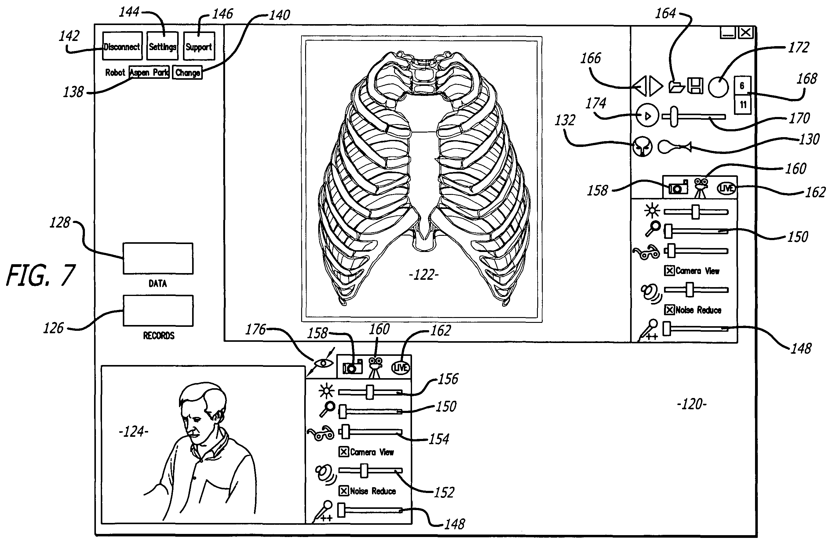 Patent US11787060 Figure 5 – Remote presence system mounted to operating room hardware