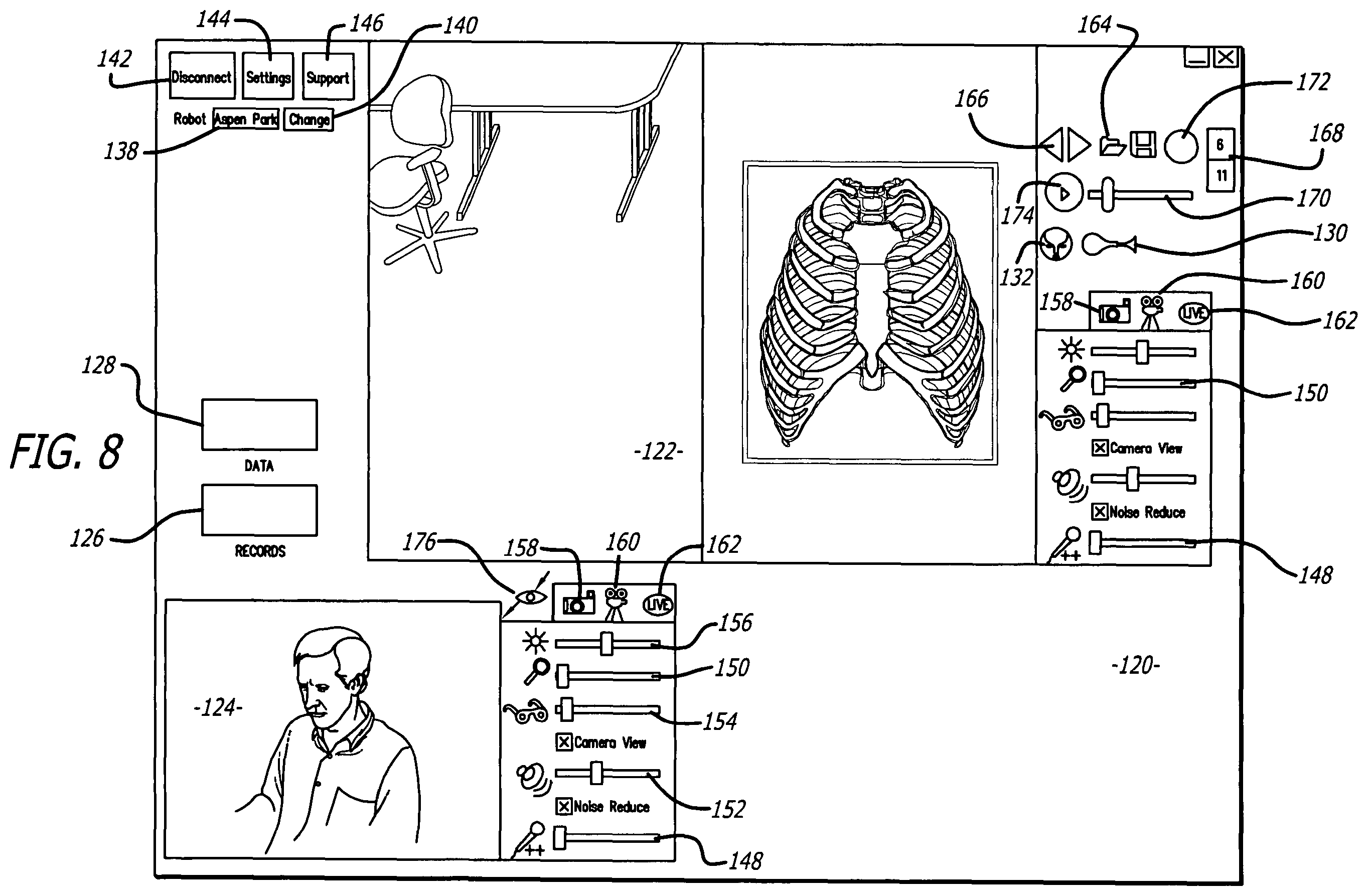 Patent US11787060 Figure 6 – Remote presence system mounted to operating room hardware
