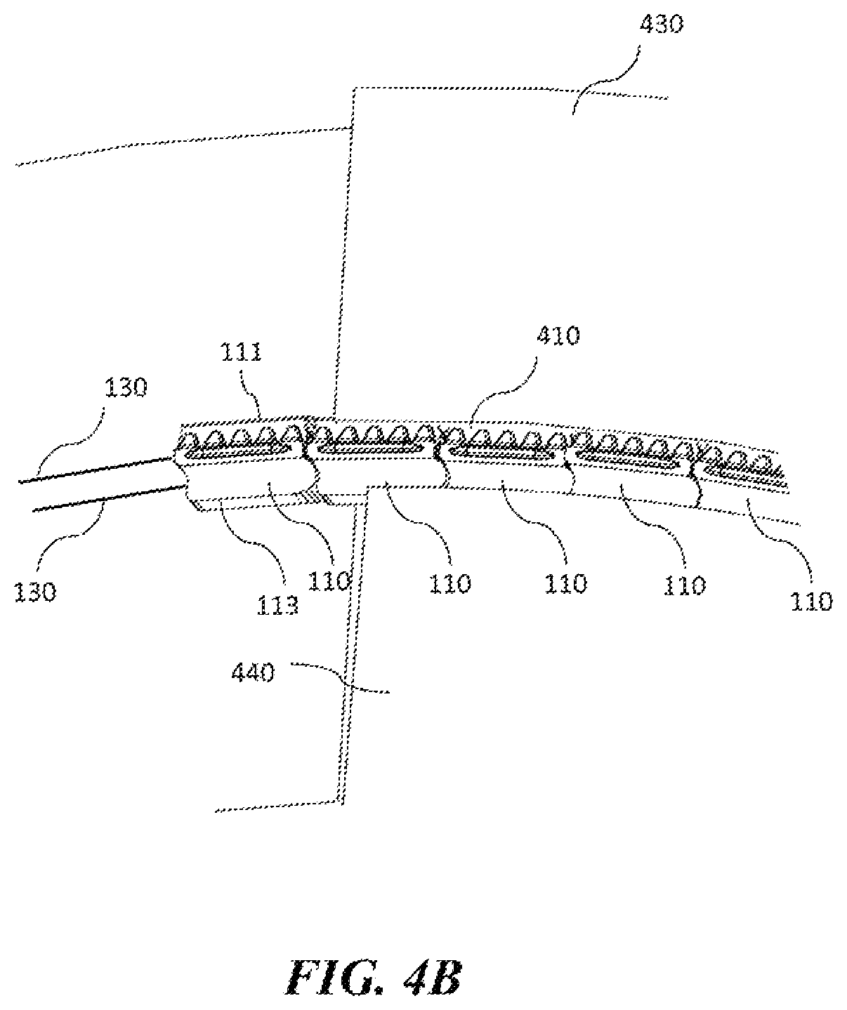 Patent US11787069 Figure 8 – Insertion tool with flexible spine