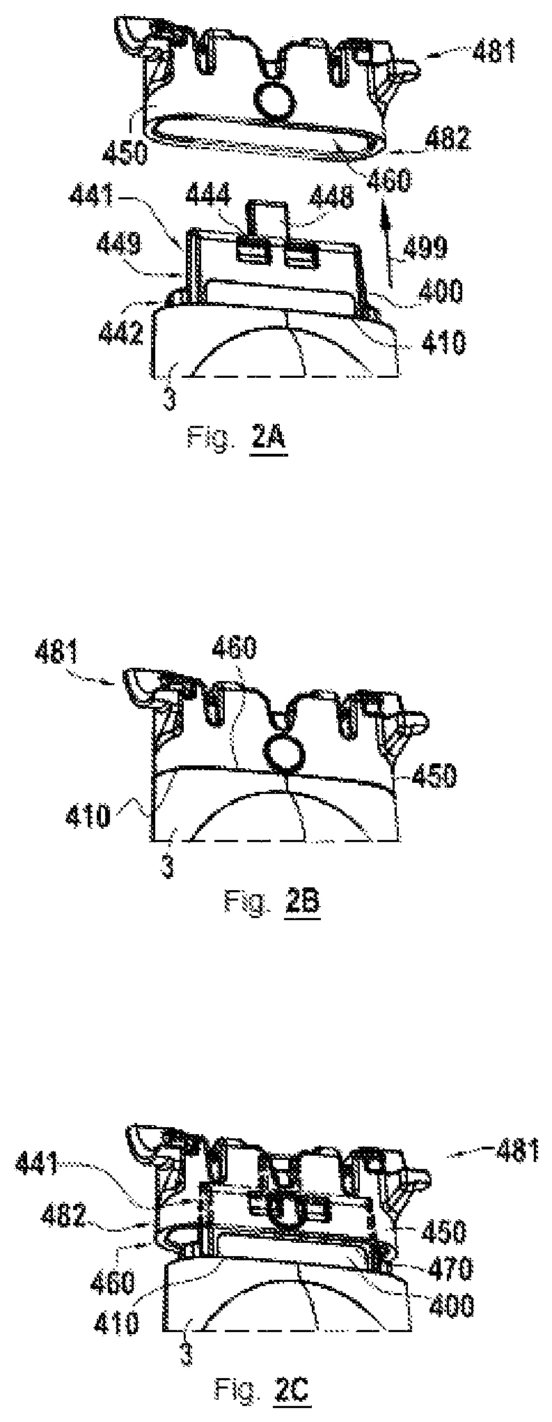 Patent US11787074 Figure 2 – Mechanical assembly of a skin care device, skin care device and process for manufacturing thereof
