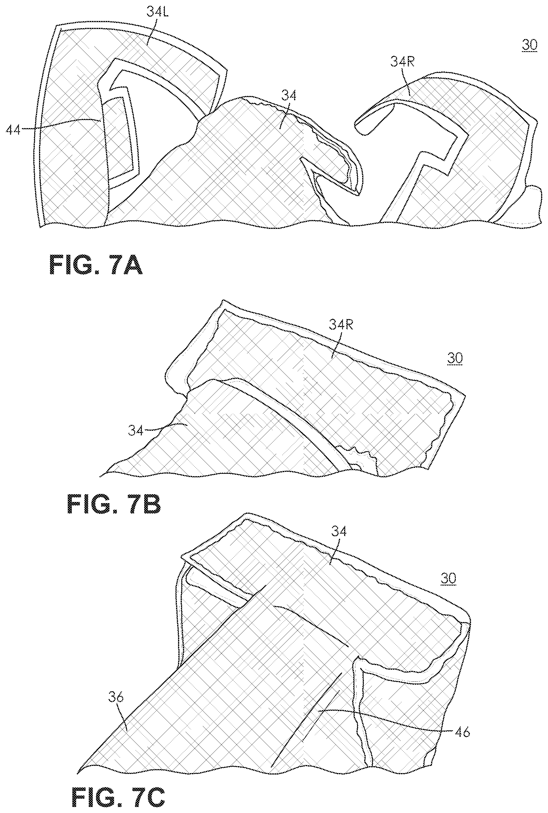 Patent US11787087 Figure 7 – Three dimensional preform created by preconsolidation of thermal plastic stitched sheet