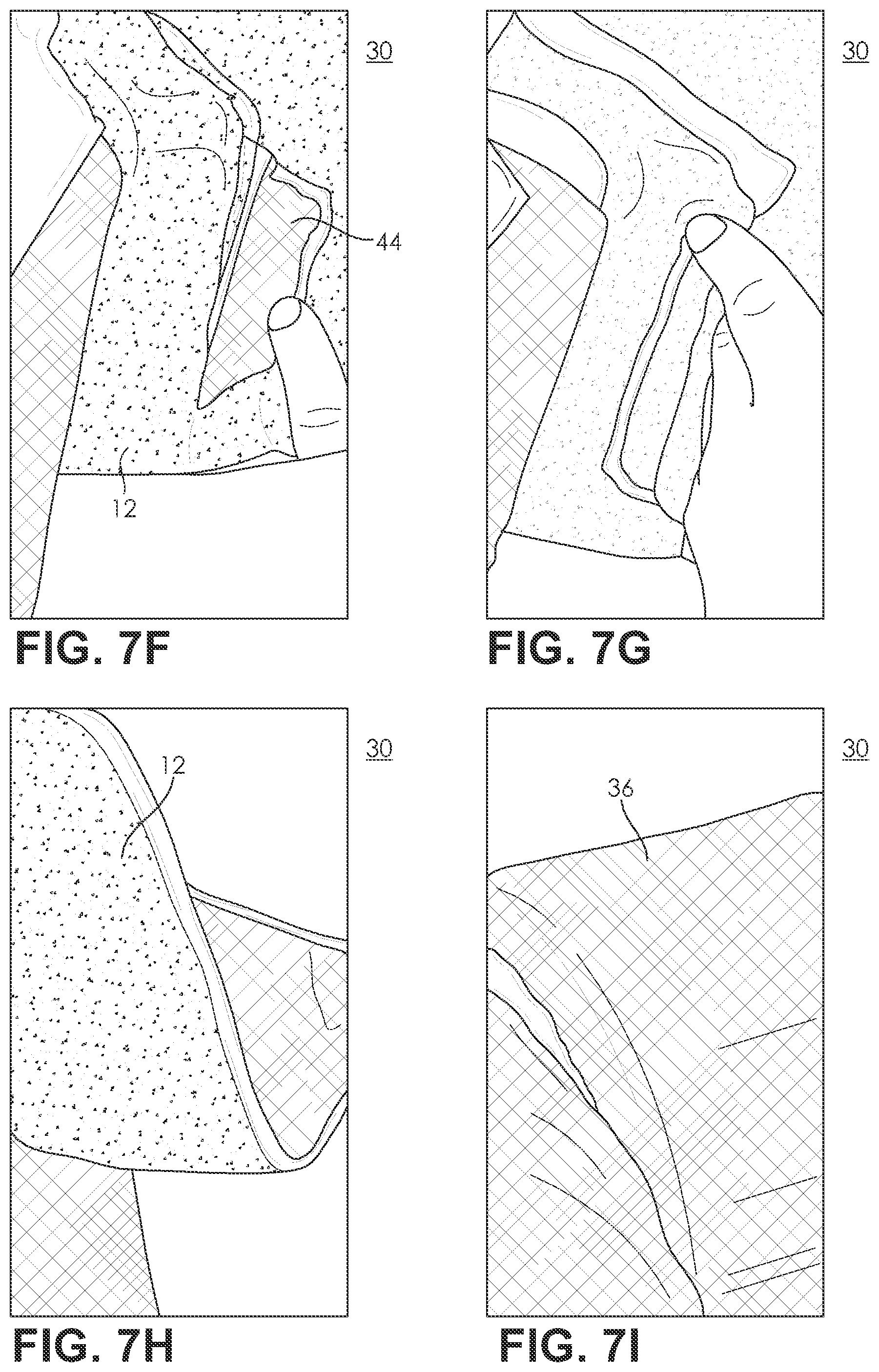 Patent US11787087 Figure 9 – Three dimensional preform created by preconsolidation of thermal plastic stitched sheet