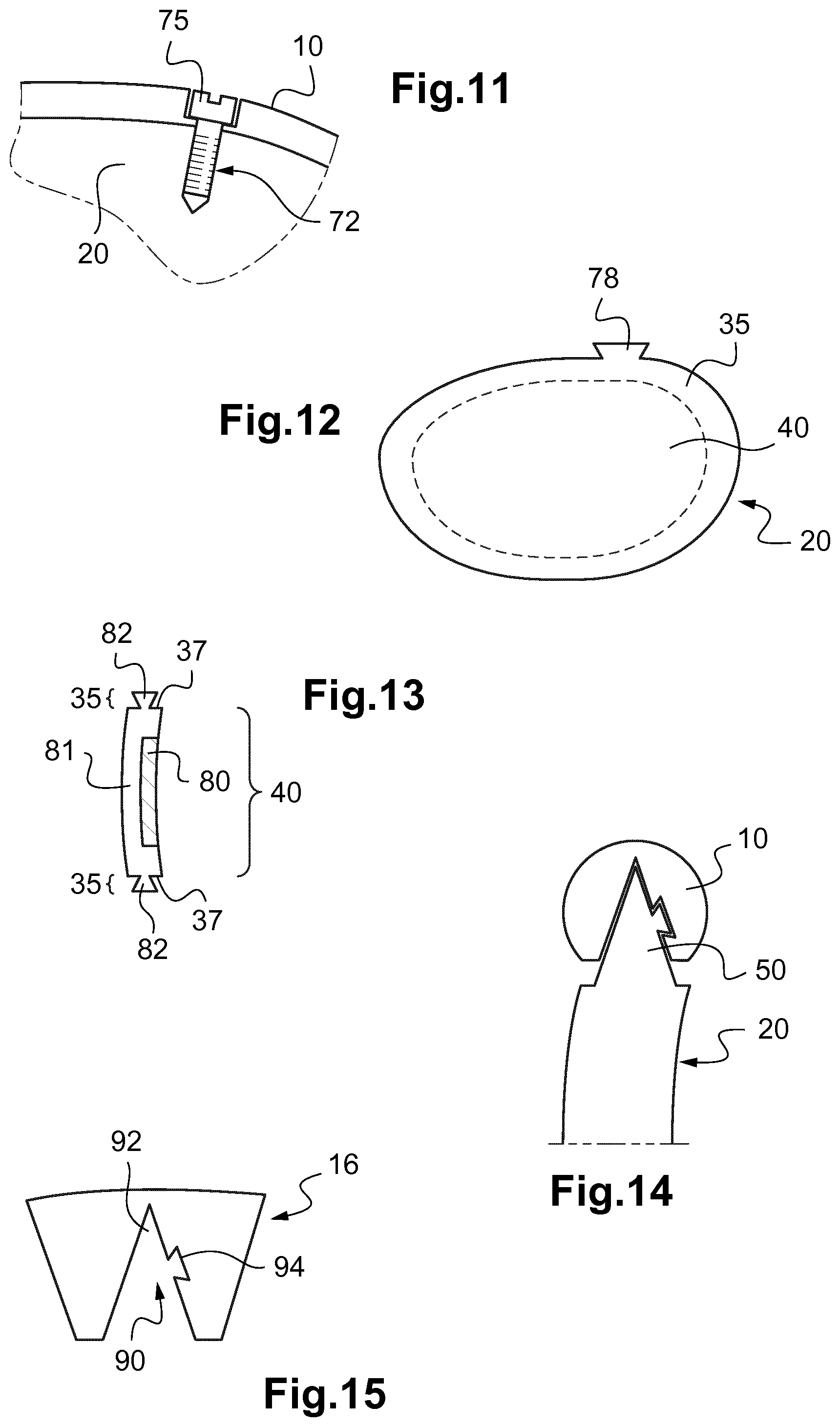 Patent US11787136 Figure 3 – Method for manufacturing an ophthalmic lens to be mounted in a frame, ophthalmic lens, frame and eyeglasses equipment