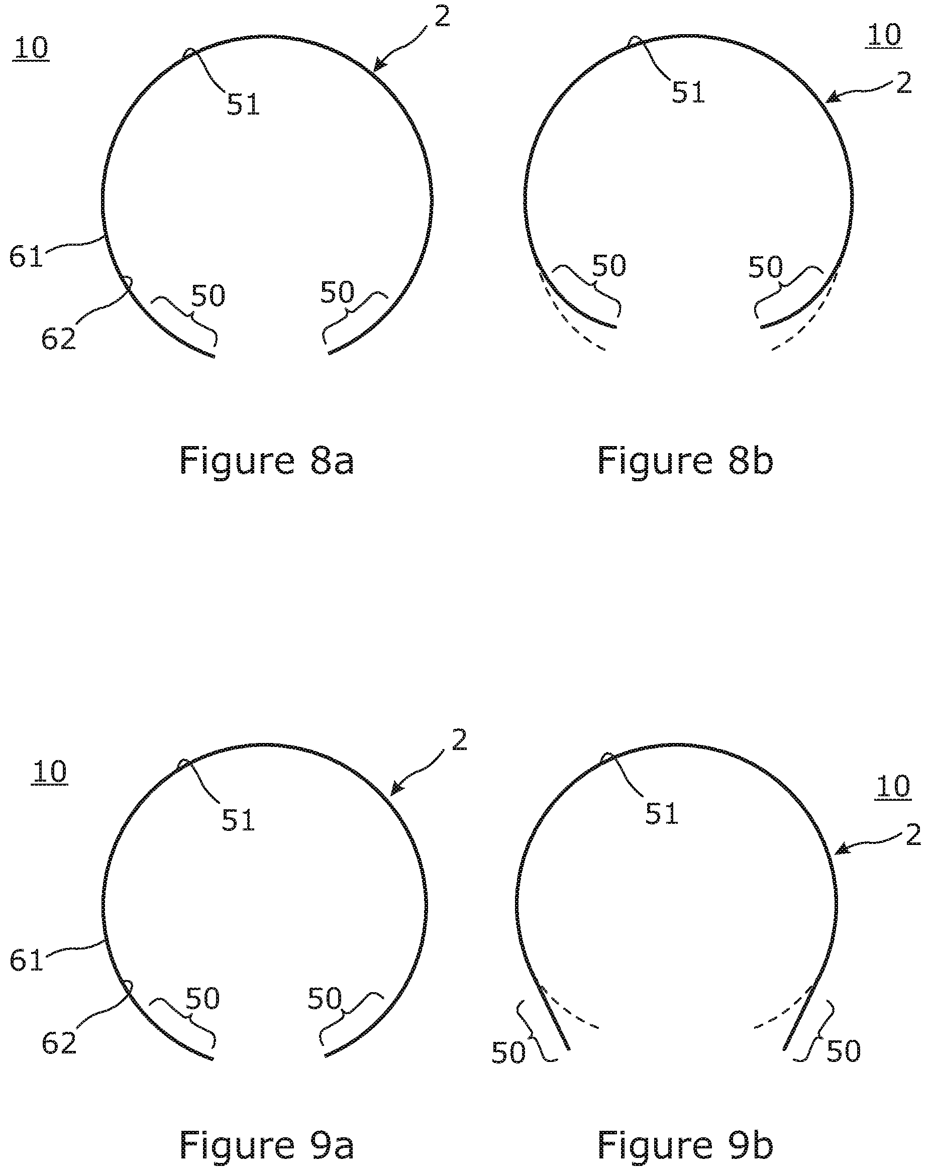 Patent US11787160 Figure 4 – Slit tube extendible members and methods for manufacturing same