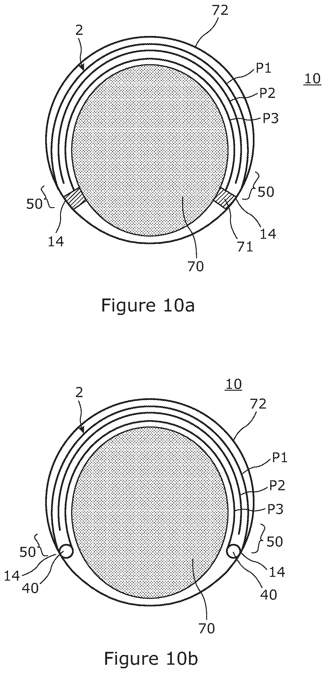 Patent US11787160 Figure 5 – Slit tube extendible members and methods for manufacturing same