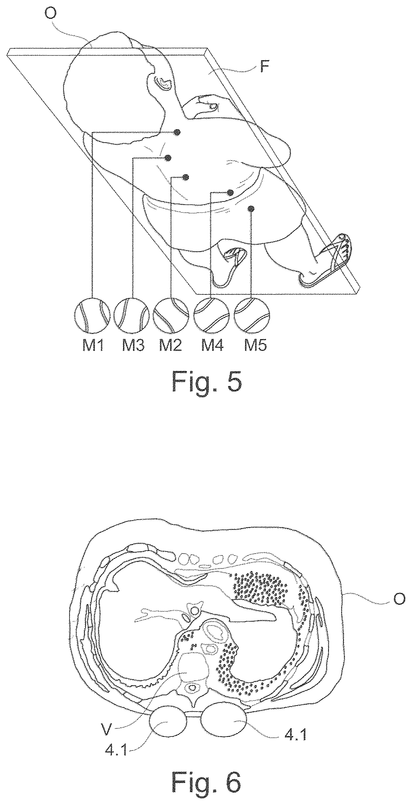 Patent US11787319 Figure 3 – Apparatus for a seat, more particularly a vehicle seat, for mobilizing at least one region of a spinal column of a seat occupant, method for sequentially driving an apparatus and seat, more particularly vehicle seat
