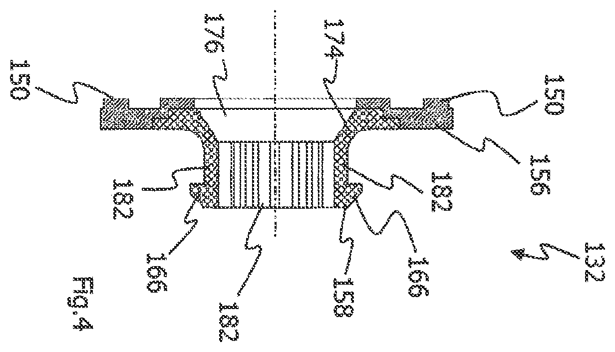 Patent US11787380 Figure 4 – Electromechanical brake booster comprising a damping element, vehicle brake system, assembly therefor and damping element