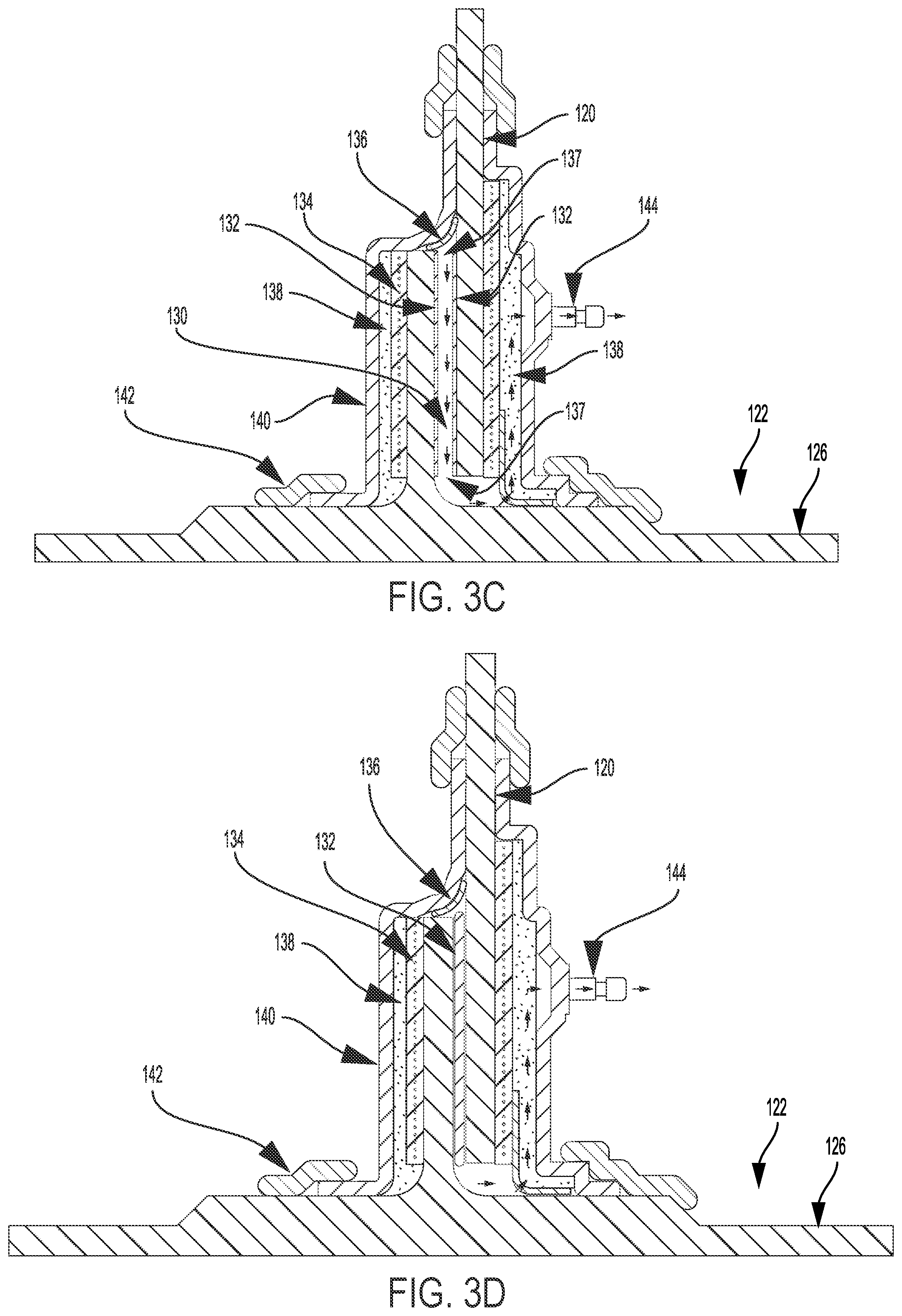 Patent US11787565 Figure 4 – Systems and methods for joining a first structure and a second structure with a choreographed adhesive de-aeration process