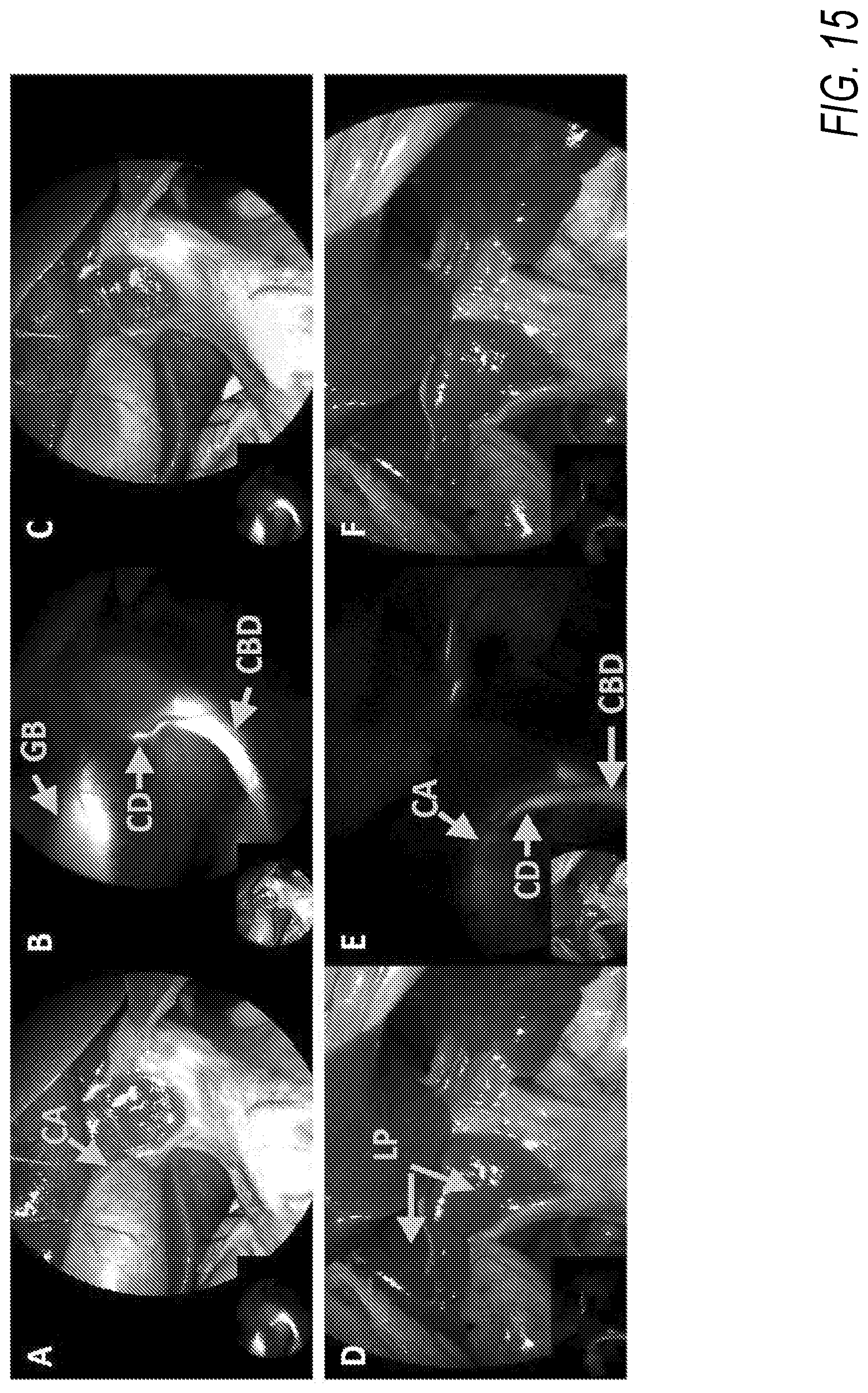 Patent US11787764 Figure 17 – Heptamethine cyanines for use as fluorescent markers of the biliary and renal systems