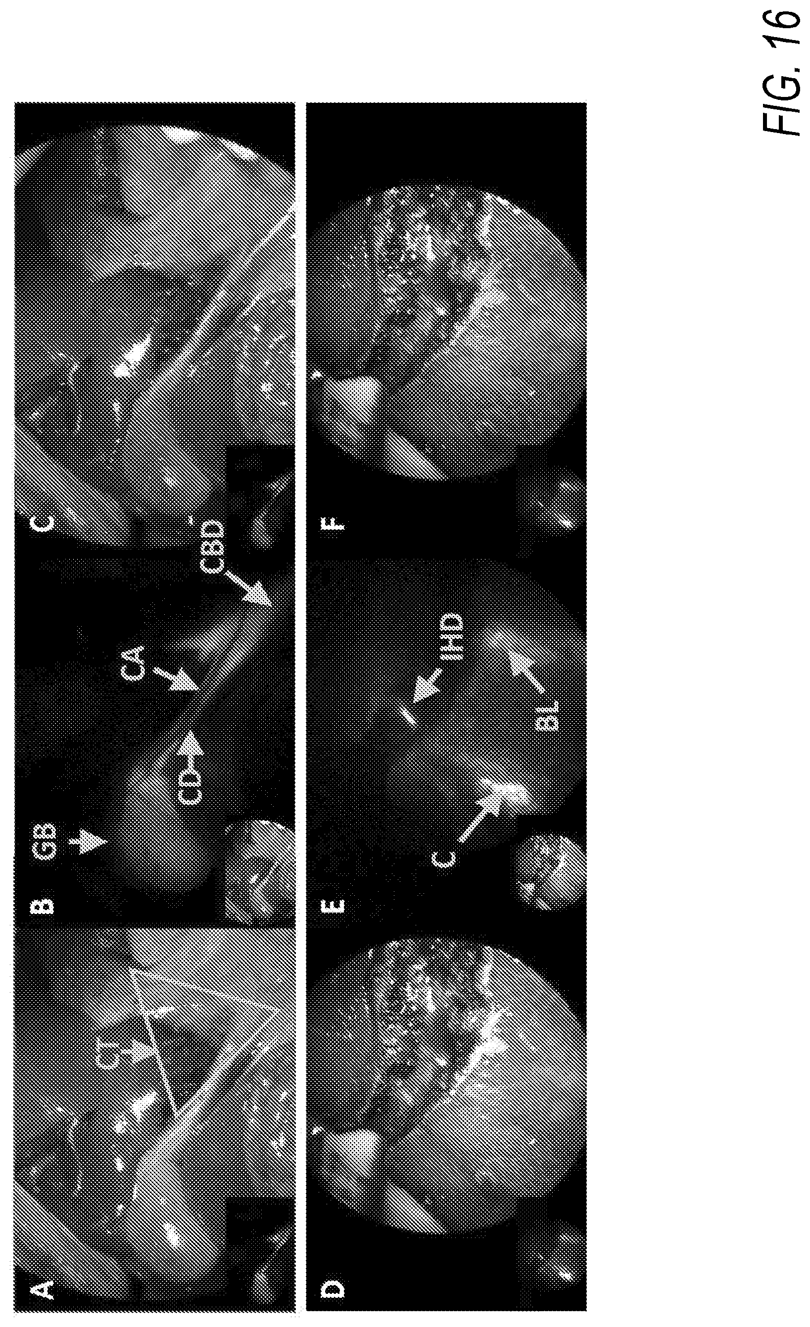 Patent US11787764 Figure 18 – Heptamethine cyanines for use as fluorescent markers of the biliary and renal systems