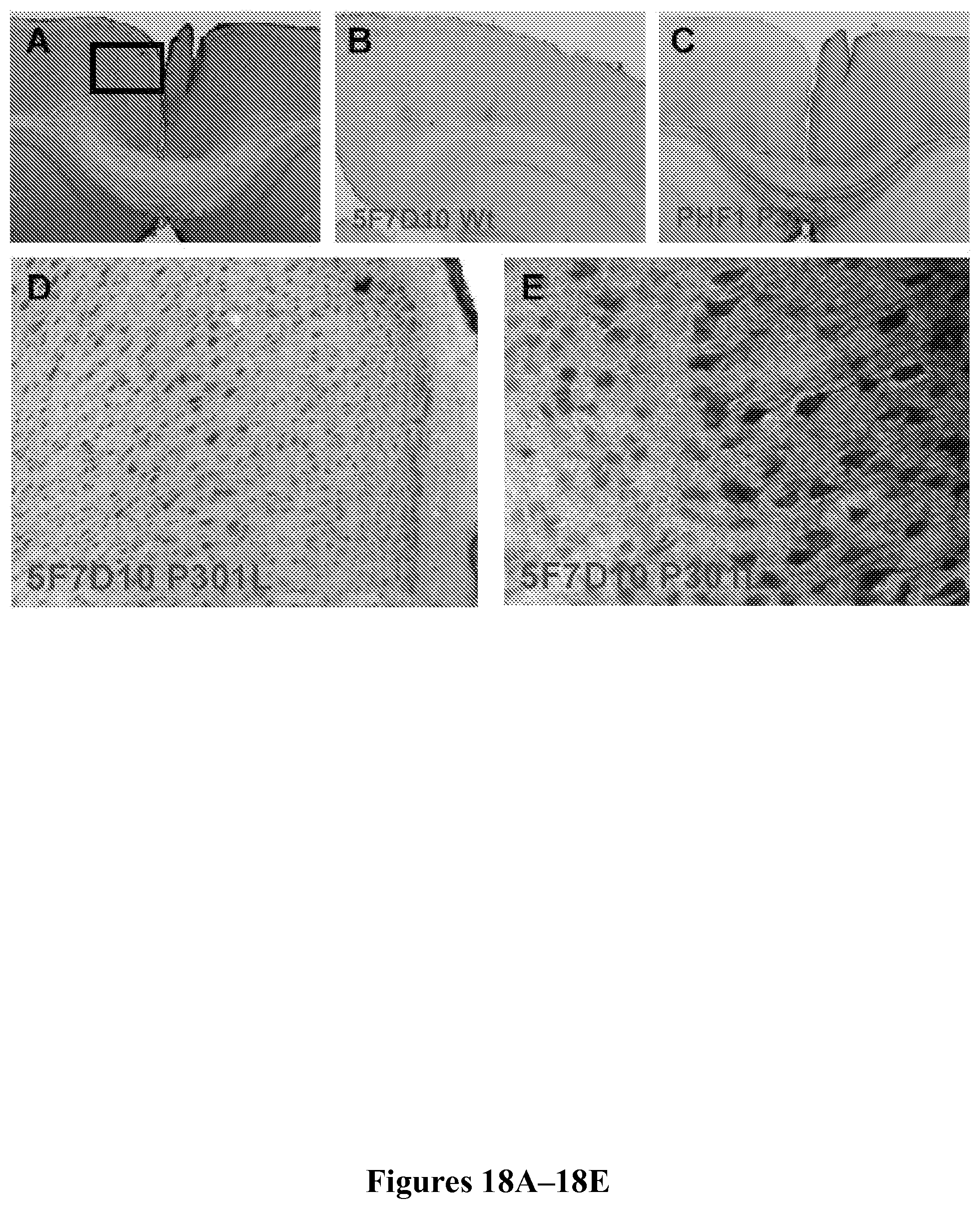 Patent US11787854 Figure 18 – Immunological targeting of pathological tau proteins