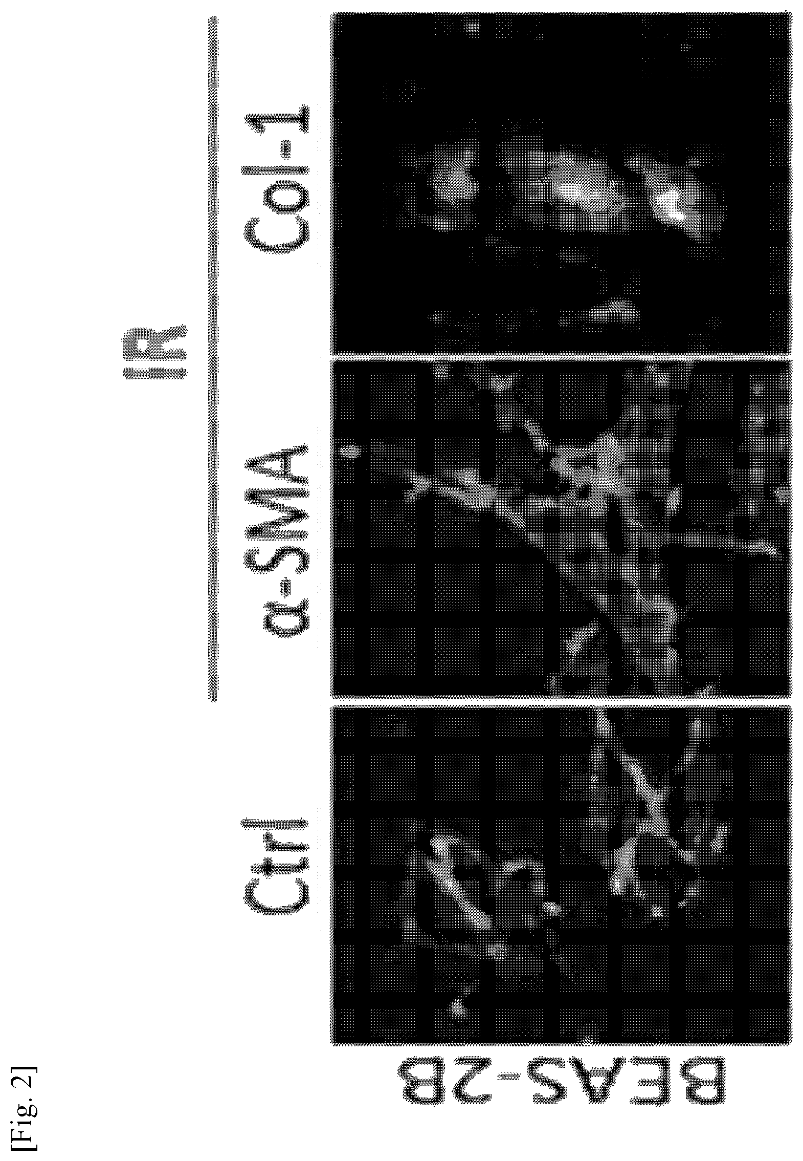 Patent US11787856 Figure 2 – Use of G-CSF antibody for treatment of pulmonary fibrosis