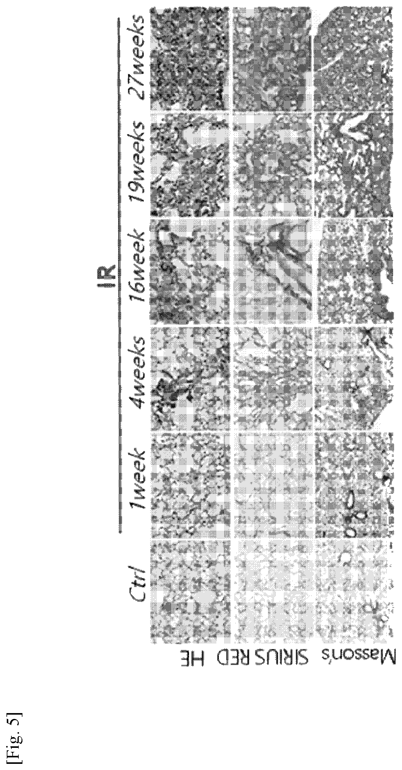 Patent US11787856 Figure 5 – Use of G-CSF antibody for treatment of pulmonary fibrosis