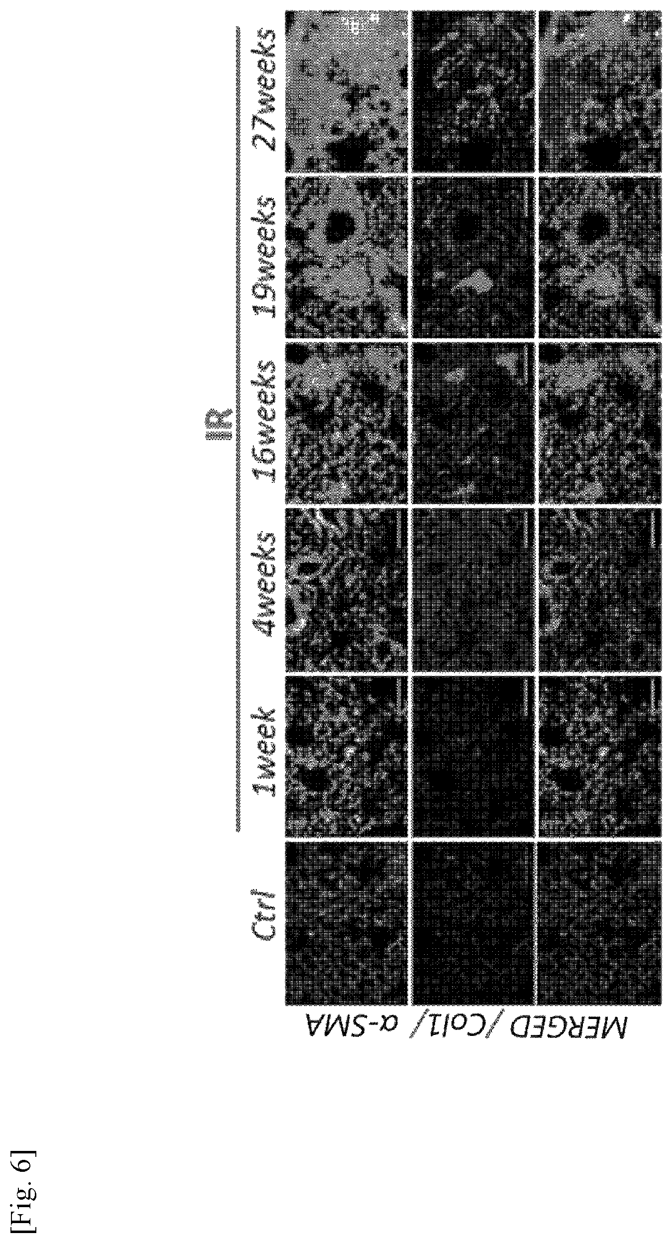 Patent US11787856 Figure 6 – Use of G-CSF antibody for treatment of pulmonary fibrosis