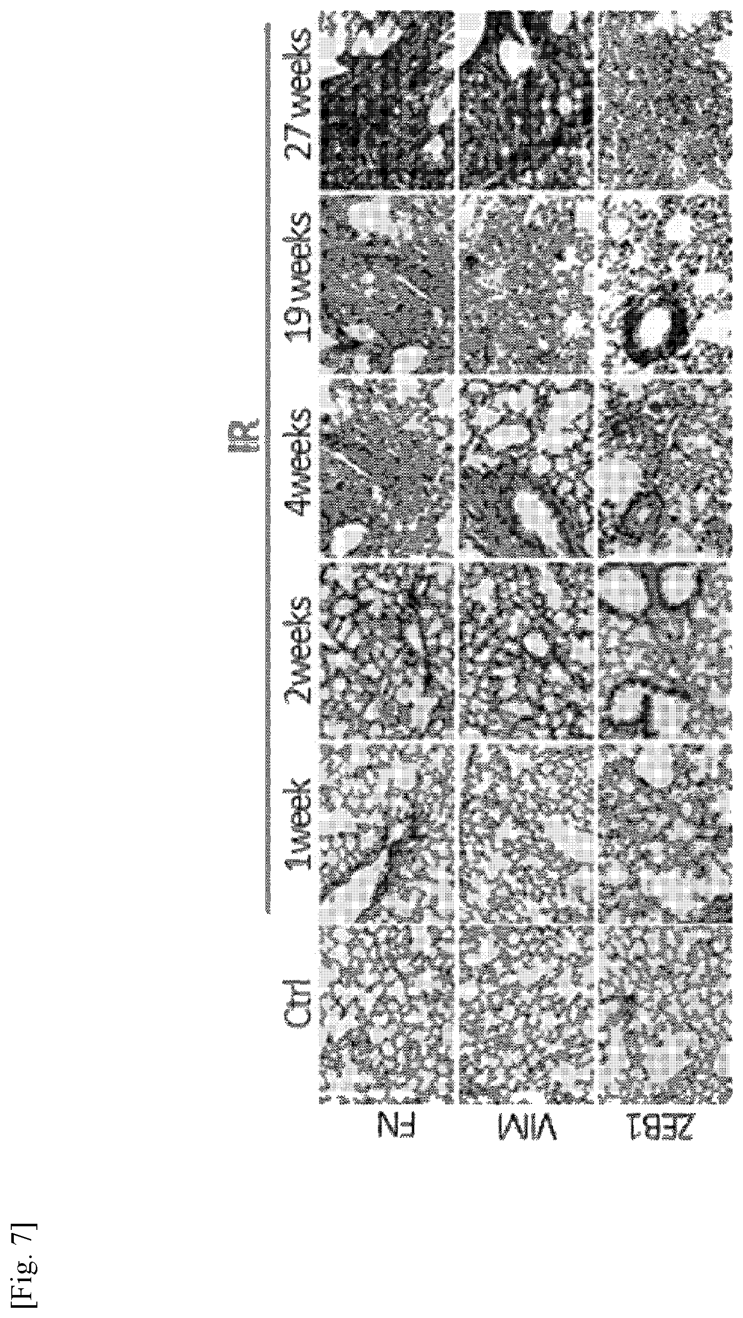 Patent US11787856 Figure 7 – Use of G-CSF antibody for treatment of pulmonary fibrosis