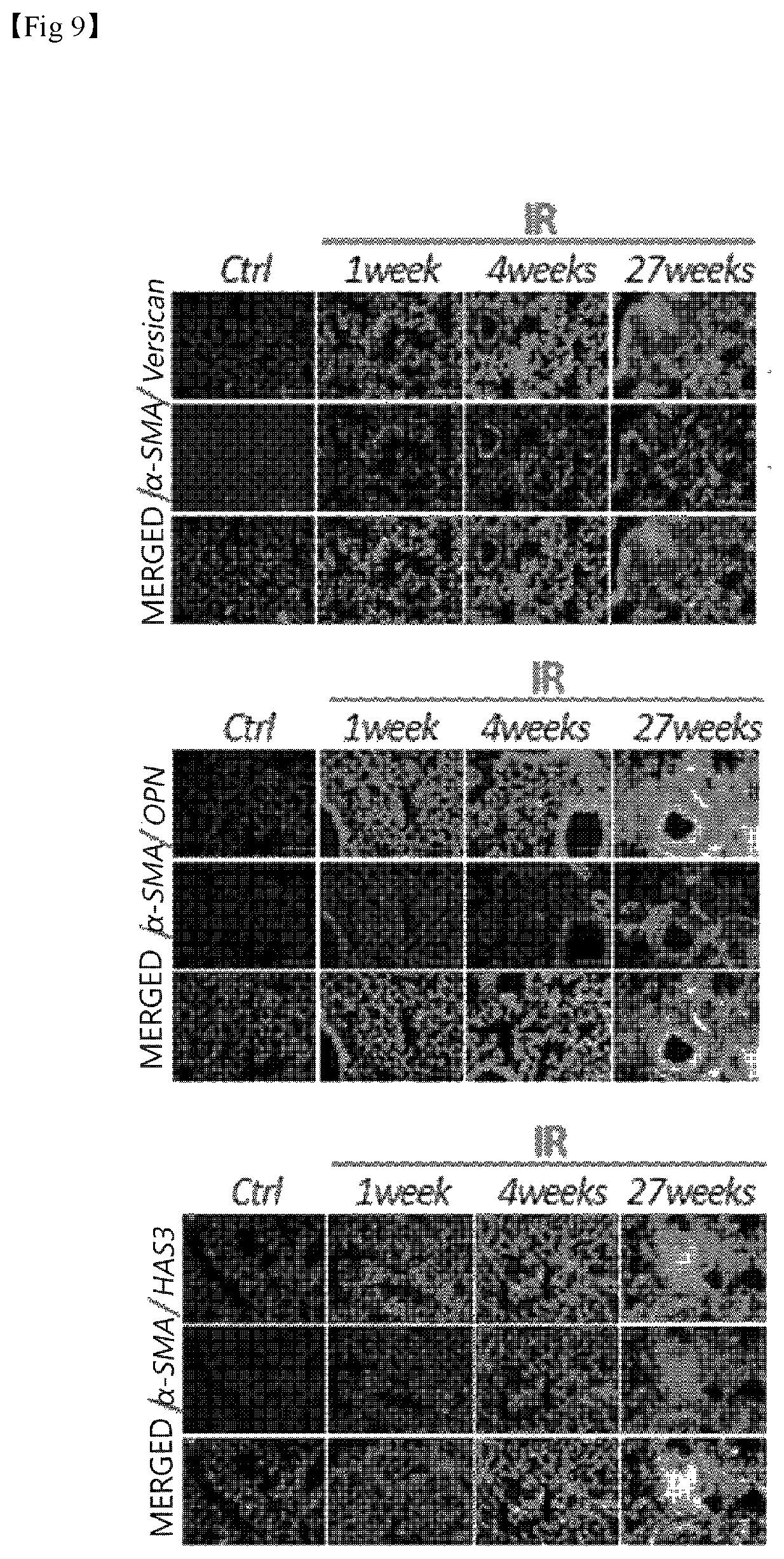 Patent US11787856 Figure 9 – Use of G-CSF antibody for treatment of pulmonary fibrosis