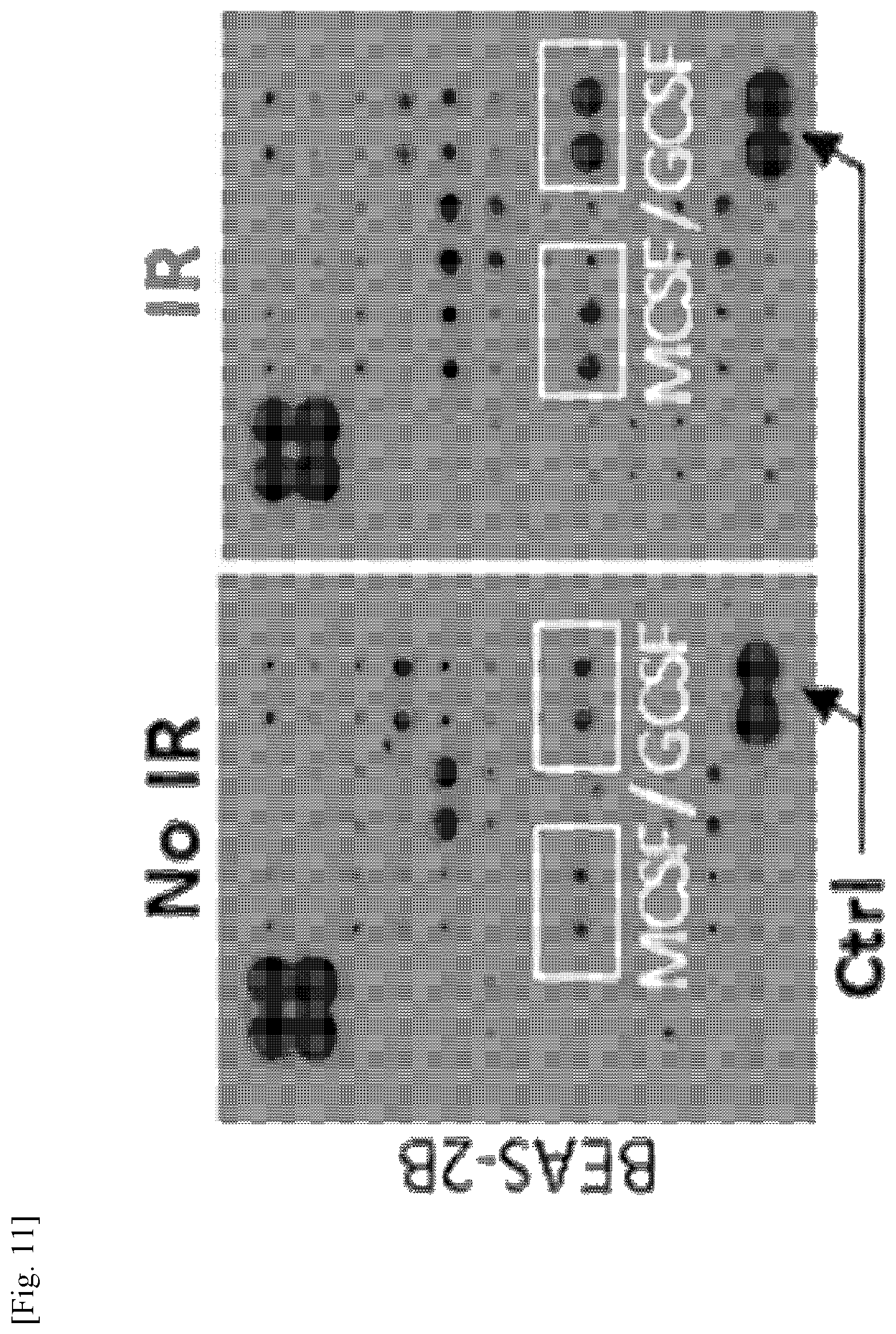 Patent US11787856 Figure 11 – Use of G-CSF antibody for treatment of pulmonary fibrosis