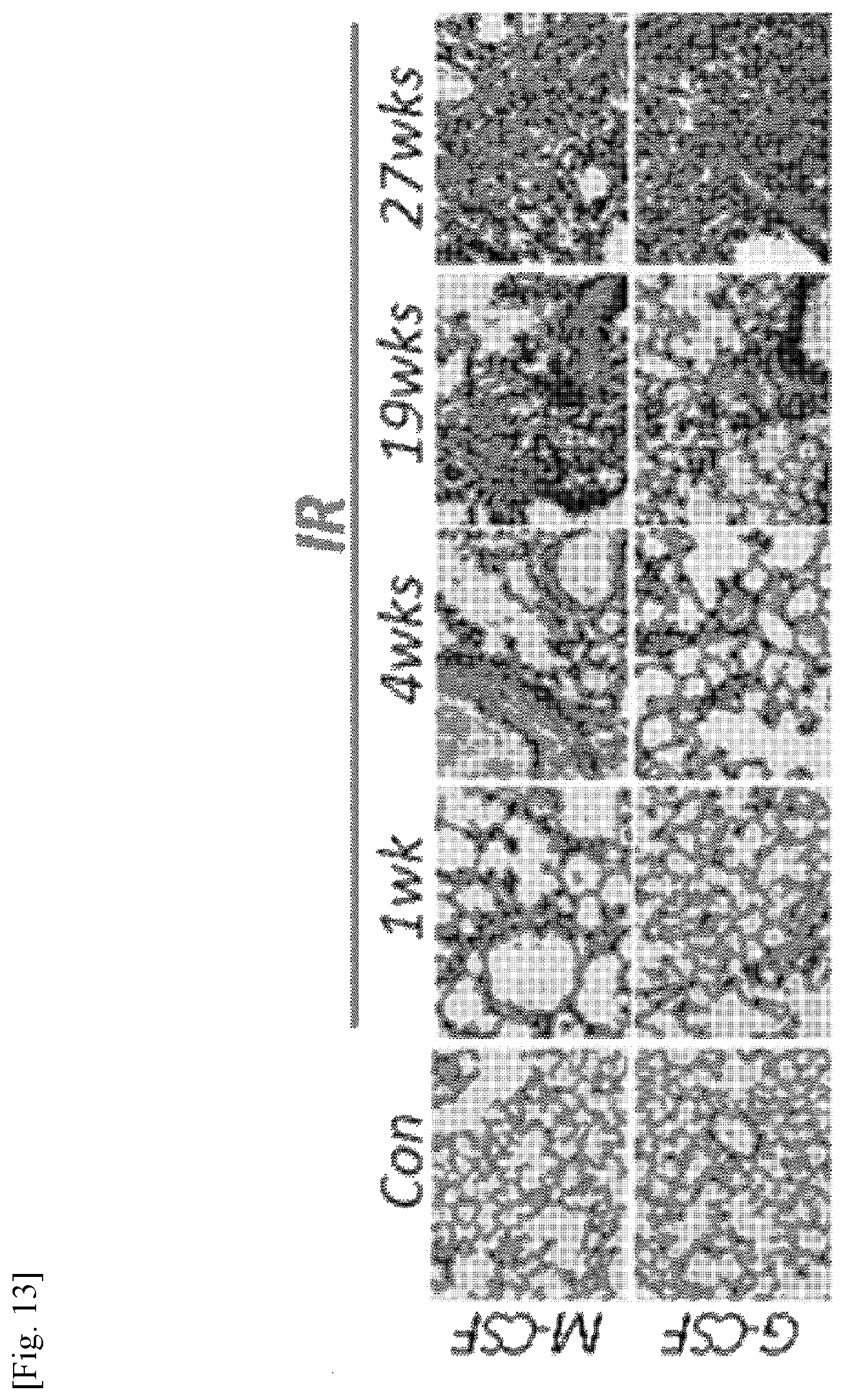 Patent US11787856 Figure 13 – Use of G-CSF antibody for treatment of pulmonary fibrosis