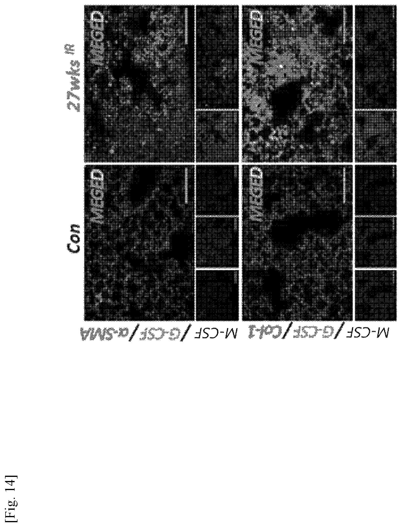 Patent US11787856 Figure 14 – Use of G-CSF antibody for treatment of pulmonary fibrosis